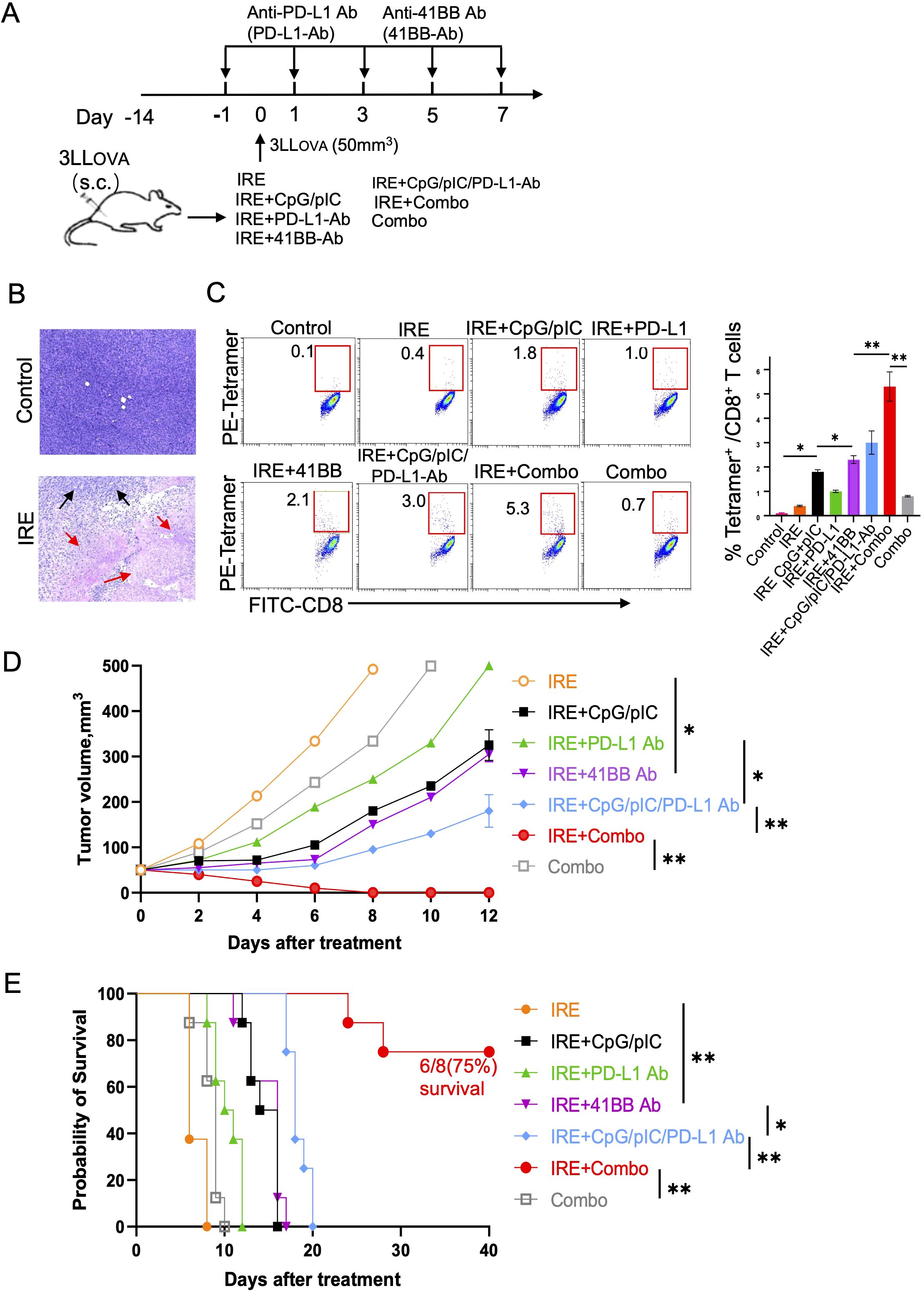 A series of panels illustrating experimental data on a mouse melanoma treatment study: A) Experimental timeline with treatment regimes of antibodies and immunotherapy combinations on mice bearing 3LL-OVA tumors. B) Histological images comparing untreated control and IRE-treated tumors, with arrows indicating necrotic areas. C) Dot plots and bar graph showing percentages of tetramer-positive CD8+ T cells across different treatment groups, with significant differences marked. D) Line graph displaying tumor volume over time for different treatments, with notable differences in tumor growth inhibition. E) Kaplan-Meier survival plot showing probability of survival across treatment groups, highlighting improved survival with certain combinations.