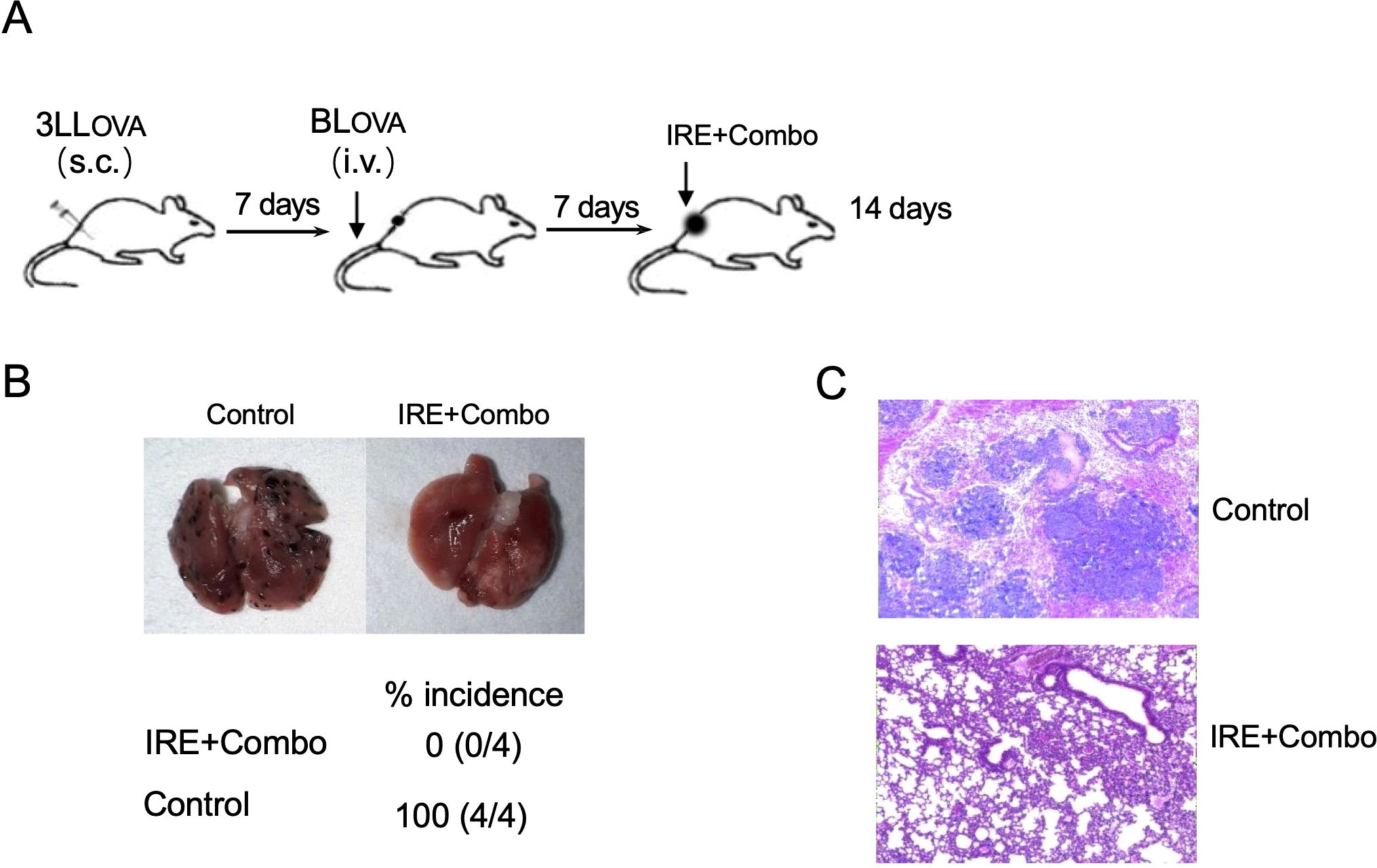 Diagram showing a multi-step experiment with mice. A) Mice injected with 3LLOVA subcutaneously, then BLOVA intravenously after 7 days, followed by IRE+Combo treatment 7 days later; 14-day observation. B) Comparison of lungs: Control shows dense metastasis, IRE+Combo shows clear tissue; incidence rates show 0% for IRE+Combo and 100% for control. C) Histological images: Control shows tumor presence, IRE+Combo shows normal tissue structure.