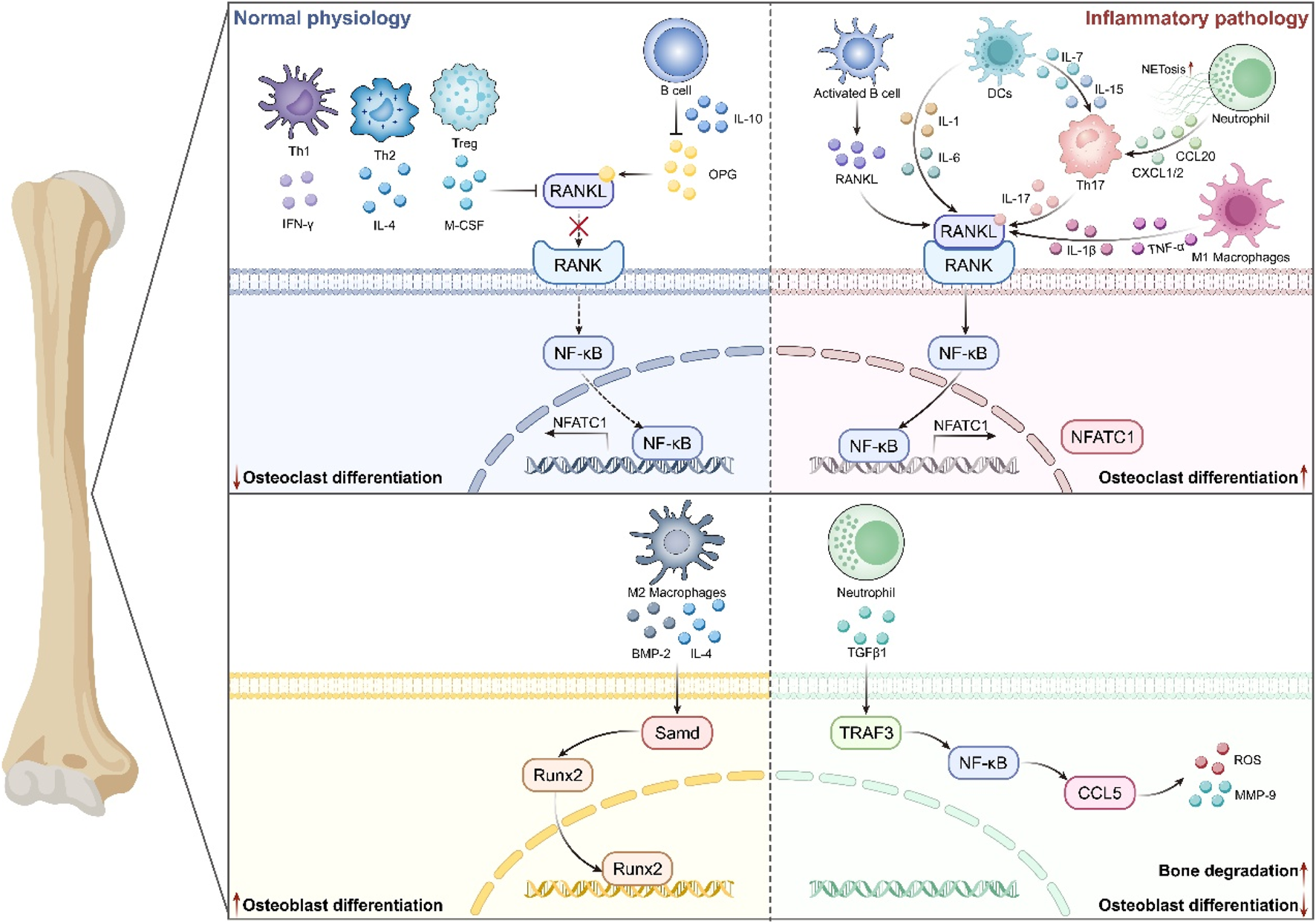 Diagram comparing normal bone physiology with inflammatory pathology, focusing on osteoclast and osteoblast differentiation. The left side depicts normal conditions with cells like Th1, Th2, and Treg influencing RANKL and RANK to reduce osteoclast differentiation. On the right, inflammatory conditions show increased RANKL activity, promoting osteoclast differentiation through NF-kB and NFATC1. The lower section illustrates osteoblast differentiation processes, involving factors like Runx2 and TRAF3. Inflammation leads to bone degradation and increased osteoblast differentiation.