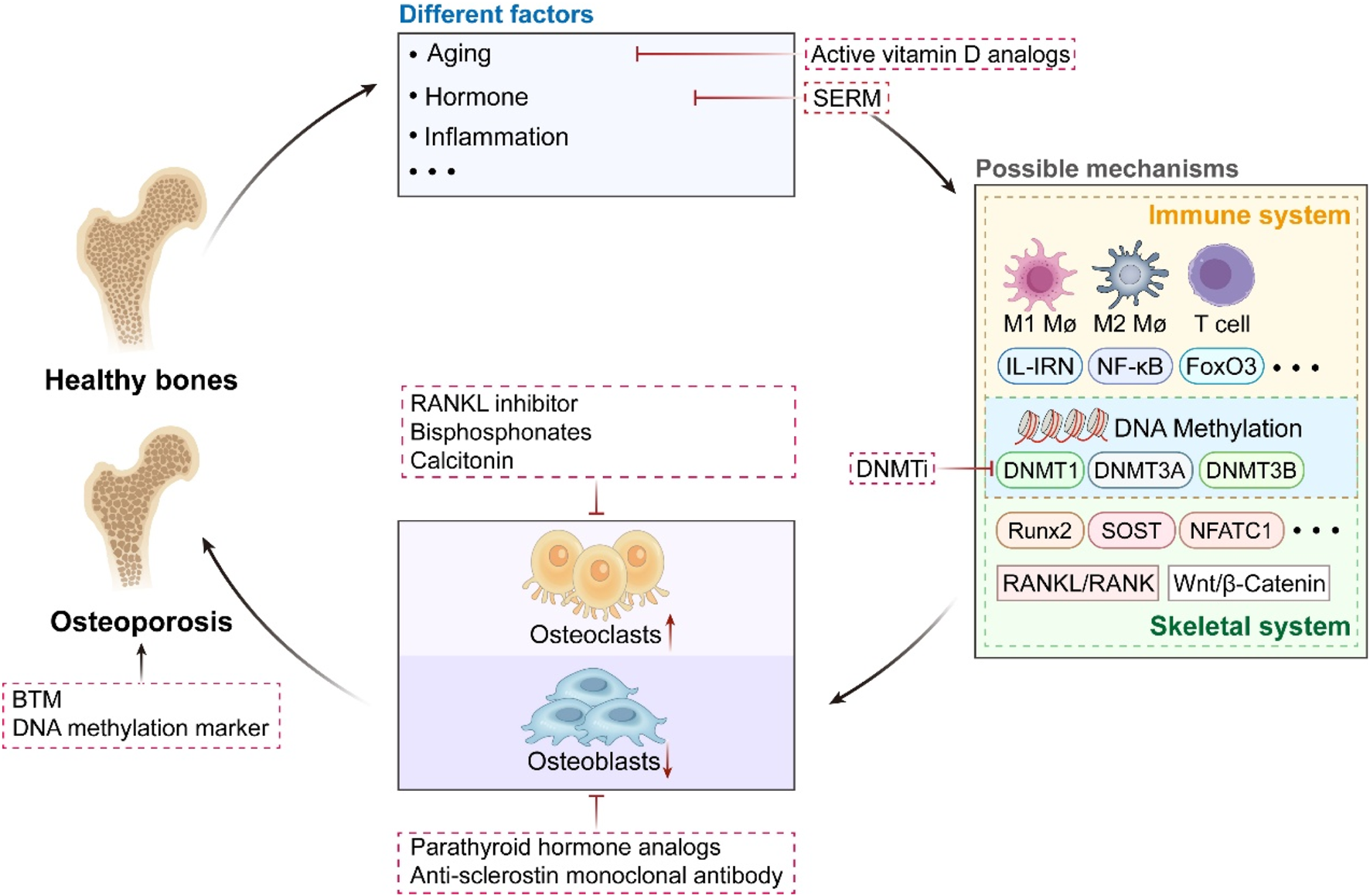 Diagram illustrating the factors and mechanisms leading to osteoporosis. It shows healthy bones transitioning to osteoporosis due to factors like aging, hormones, and inflammation. Treatments include RANKL inhibitors and bisphosphonates, while mechanisms involve immune system pathways and DNA methylation. Osteoclasts and osteoblasts are depicted, with references to the skeletal system and immune system components.