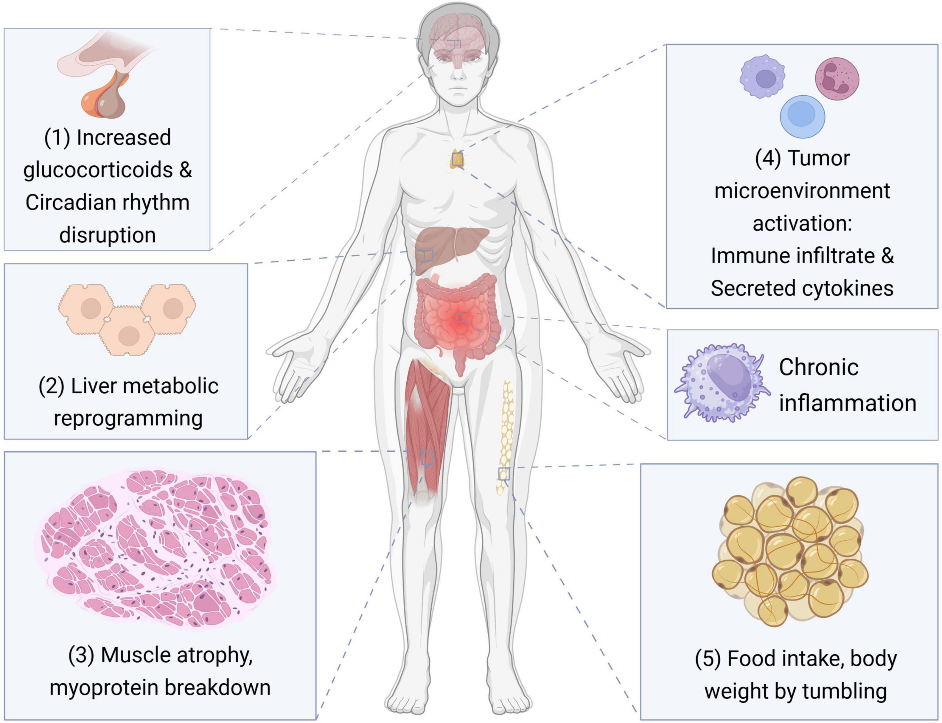 Illustration of a human body with labeled regions depicting physiological effects related to glucocorticoids and circadian rhythm disruption, liver metabolic reprogramming, muscle atrophy, tumor microenvironment activation, chronic inflammation, and changes in food intake and body weight. Each label highlights different systemic impacts, like immune infiltration and cytokine secretion, corresponding to specific areas on the body.