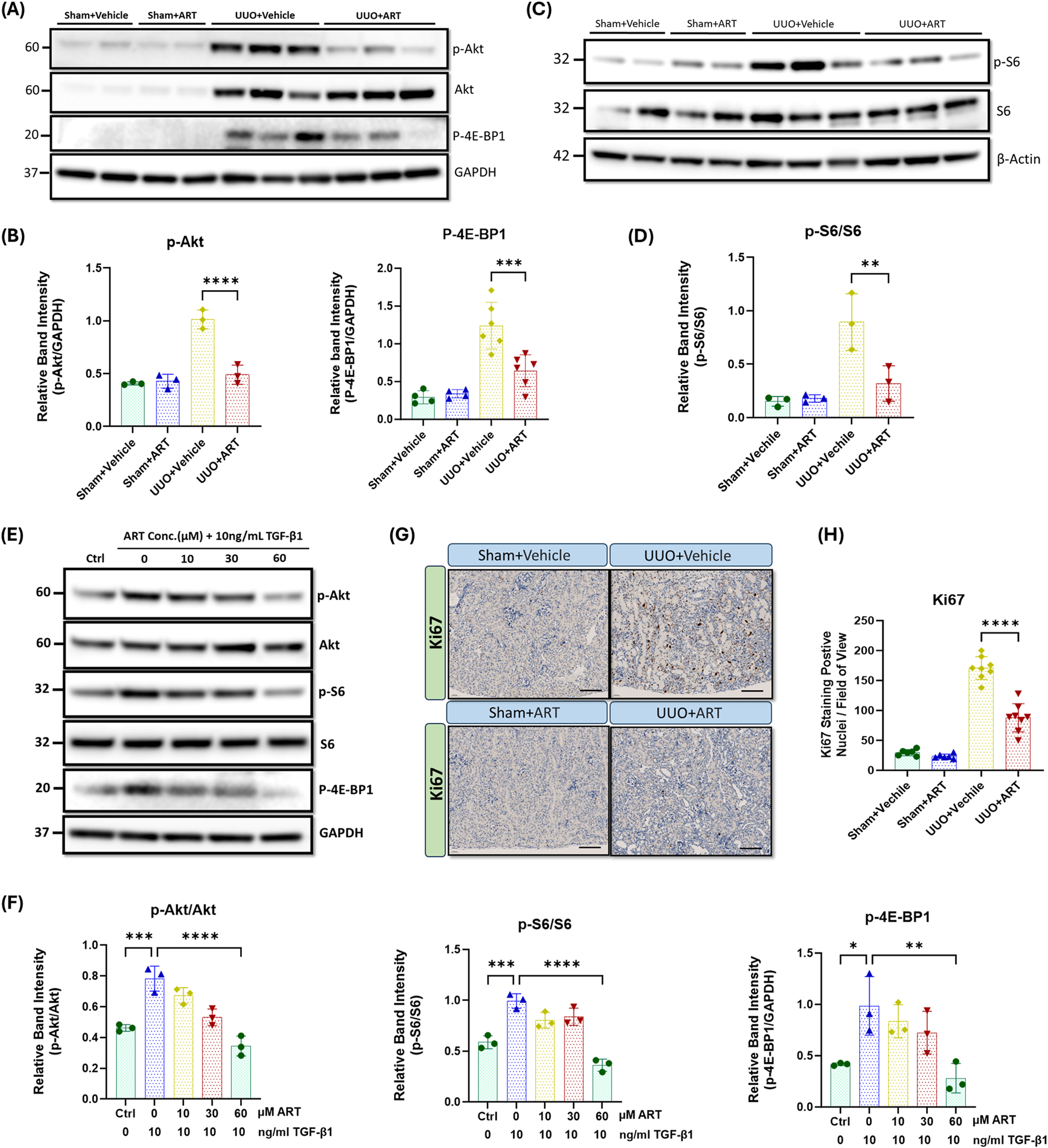 Western blots and bar graphs show protein expression levels of p-Akt, Akt, p-4E-BP1, GAPDH, p-S6, S6, and β-Actin across various treatments in panels A, C, E, with relative band intensity quantified in graphs B, D, F. Immunohistochemistry images G depict Ki67 staining in Sham and UUO conditions, with quantification shown in graph H. Statistical significance is indicated with asterisks.