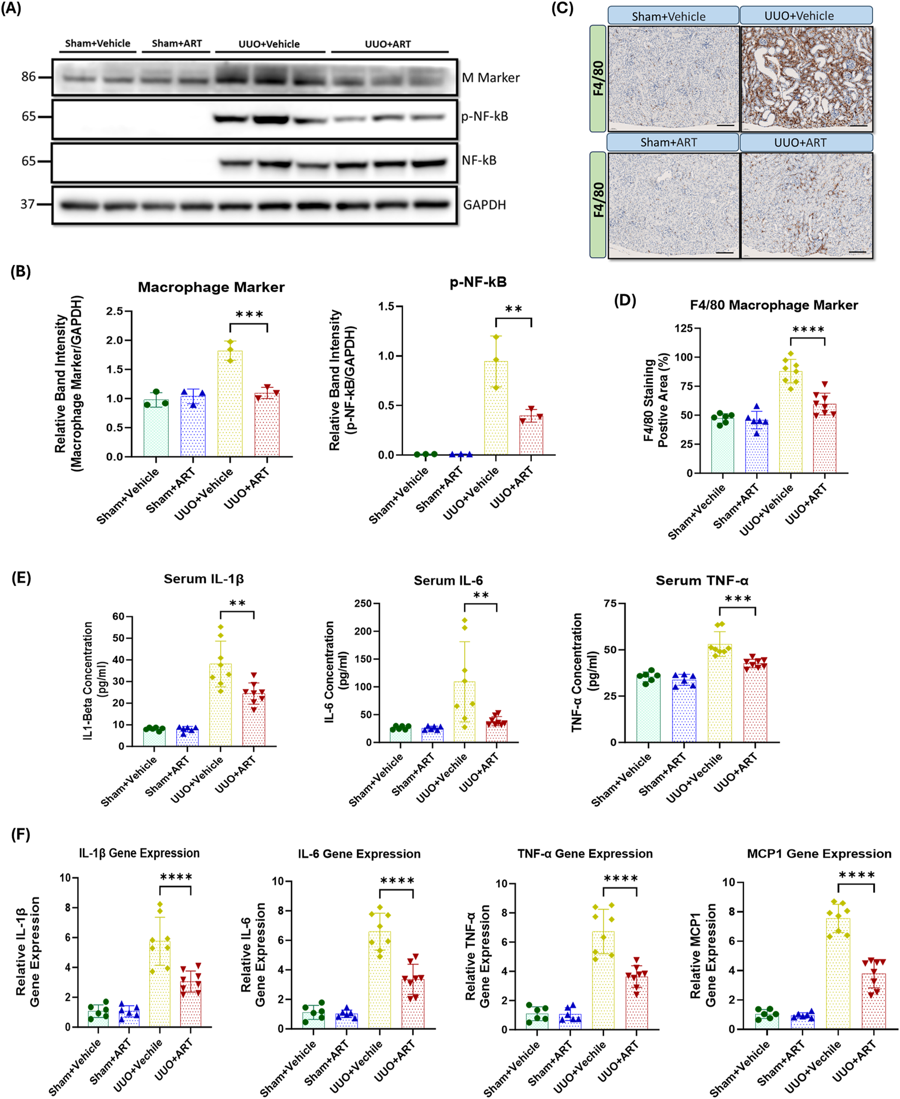 Four panels display scientific data:(A) Western blot analysis shows protein bands for Macrophage Marker, p-NF-κB, NF-κB, and GAPDH across different treatments: Sham+Vehicle, Sham+ART, UUO+Vehicle, UUO+ART.(B) Bar graphs illustrate relative band intensity for Macrophage Marker and p-NF-κB, showing significant differences marked by asterisks.(C) Immunohistochemistry images of F4/80 show staining differences for Sham+Vehicle, UUO+Vehicle, Sham+ART, and UUO+ART.(D) Bar graph for F4/80 Macrophage Marker shows significant staining differences.(E) Bar graphs depict serum concentrations of IL-1β, IL-6, and TNF-α.(F) Gene expression levels of IL-1β, IL-6, TNF-α, and MCP1 are shown, with significant differences indicated.