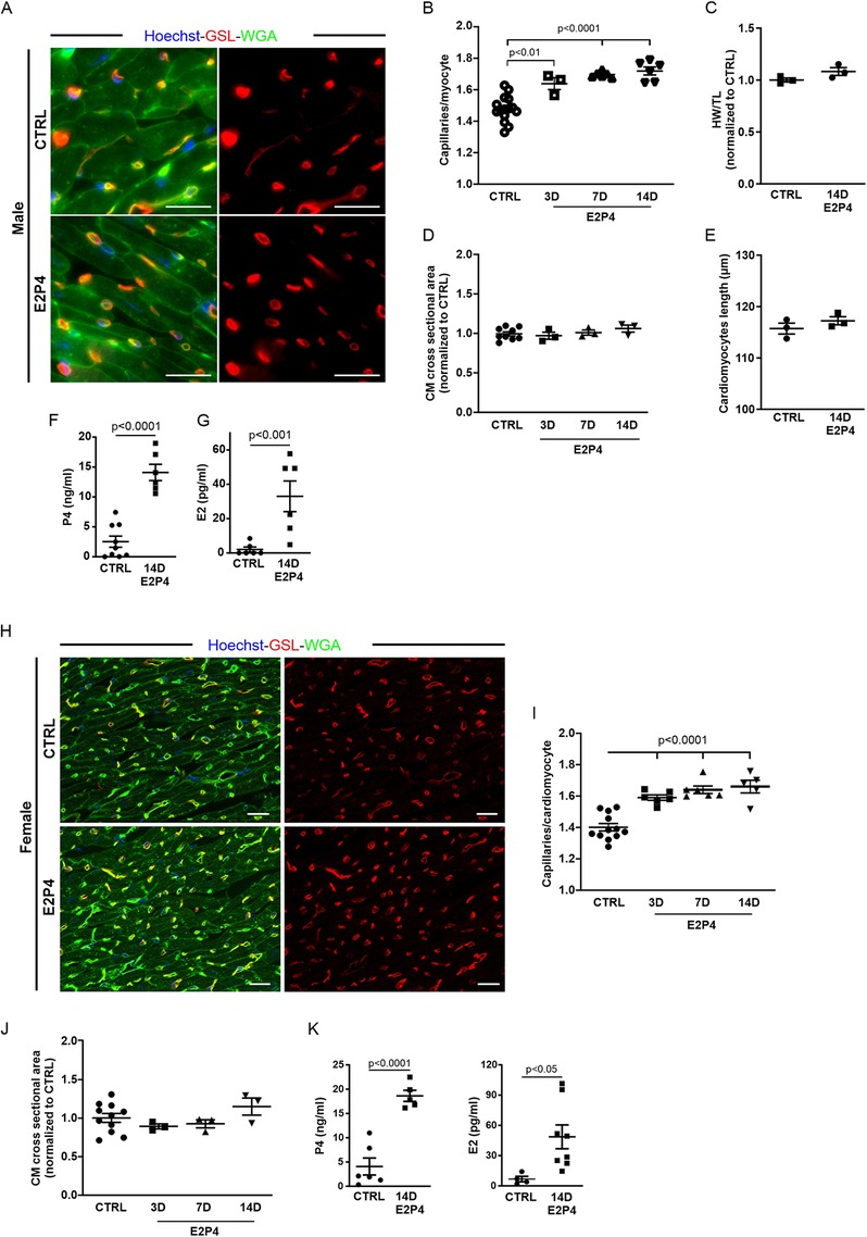 Panel A shows images of cardiac tissue from male subjects stained with Hoechst, GSL, and WGA for control (CTRL) and E2P4 groups. Panels B to G display graphs of various measured parameters such as capillary density, HWTL, CM cross-sectional area, cardiomyocyte length, and hormone levels (P4 and E2). Panel H presents similar stained images from female subjects. Panels I to K display corresponding graphs for females, showing capillary density, CM cross-sectional area, and hormone levels. Statistical significance is indicated in several graphs.
