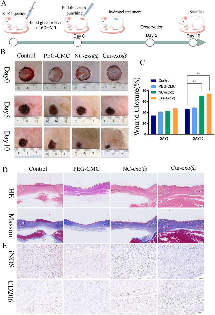 Diagram illustrating a study on the effects of different treatments on wound healing in mice. A timeline at the top details the procedure, including STZ injection, full-thickness punching, hydrogel treatment, and observation. Images in section B show wound progression on days 0, 5, and 10 under different treatments: Control, PEG-CMC, NC-exo@, and Cur-exo@. Graph C presents wound closure percentages, showing significant improvement in Cur-exo@ and NC-exo@ groups. Section D shows histological images from HE and Masson's trichrome staining for each treatment. Section E displays immunohistochemical staining for iNOS and CD206.