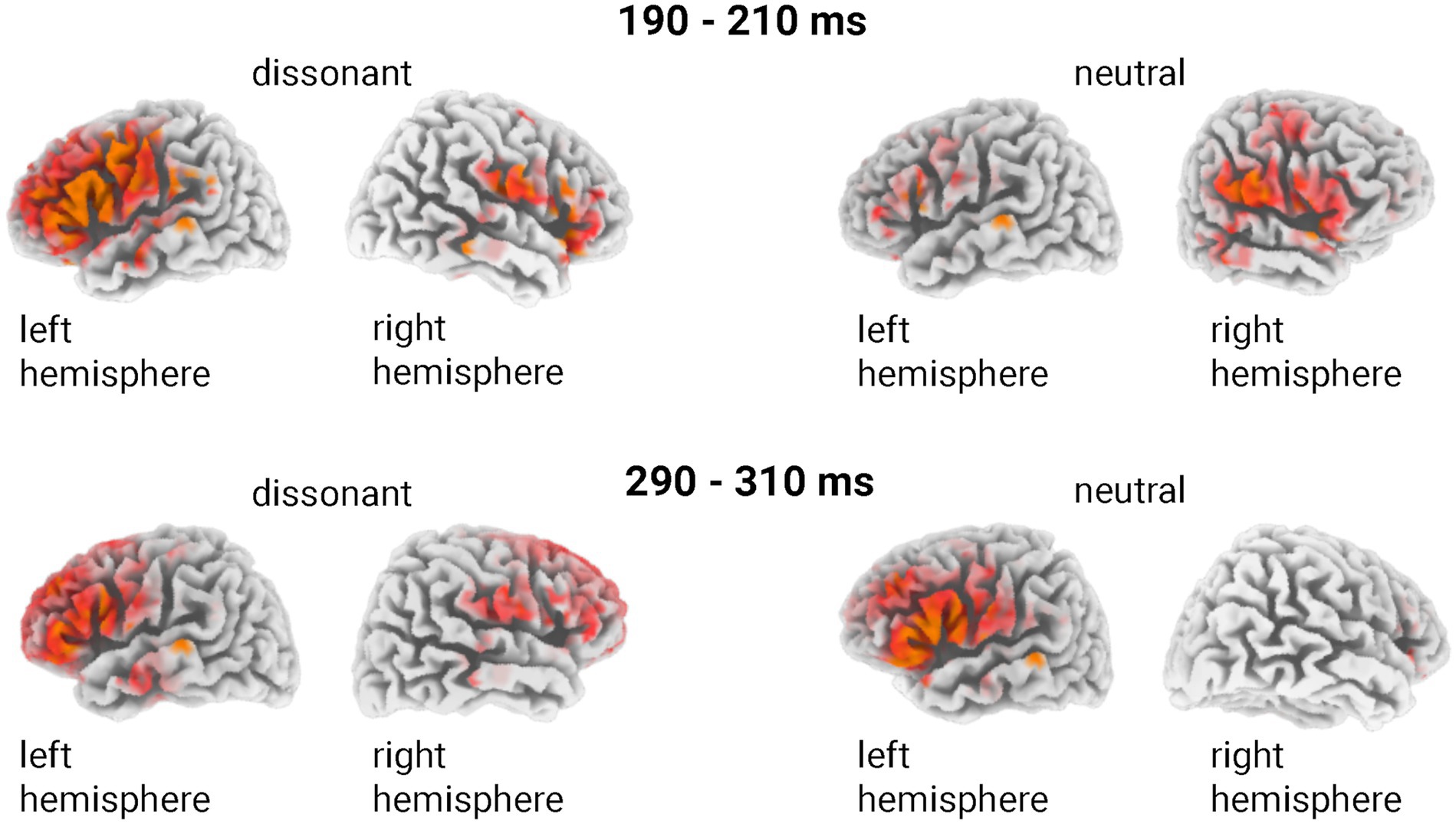 Four images of brain hemispheres showing neural activity in two time intervals, 190-210 ms and 290-310 ms. Dissonant stimuli images show more activity compared to neutral stimuli in both left and right hemispheres, illustrated with red and orange highlights.