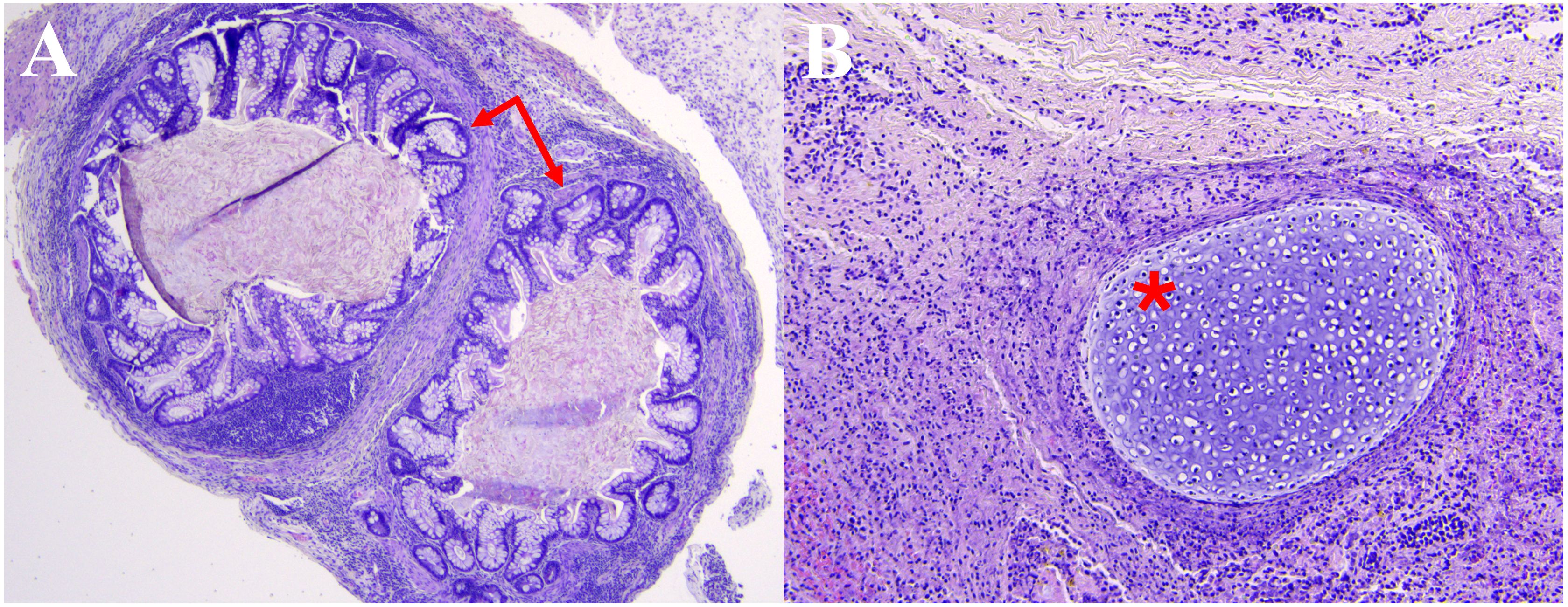 Microscopic images in two panels labeled A and B. Panel A shows intestinal tissue with highlighted by a red arrow. Panel B displays collagen marked with a red asterisk. Both images are stained to reveal cellular structures.