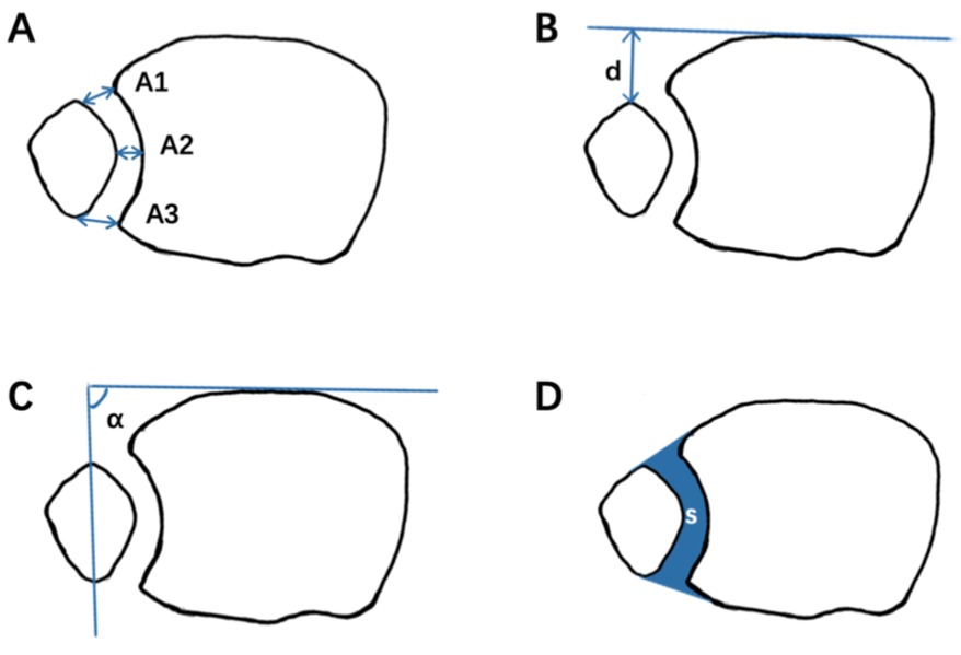 Diagram depicting four views of two adjacent shapes labeled A, B, C, and D. A shows distances between shapes with arrows labeled A1, A2, A3. B shows vertical distance labeled d. C shows an angle α between a vertical and horizontal line. D highlights an area labeled s.
