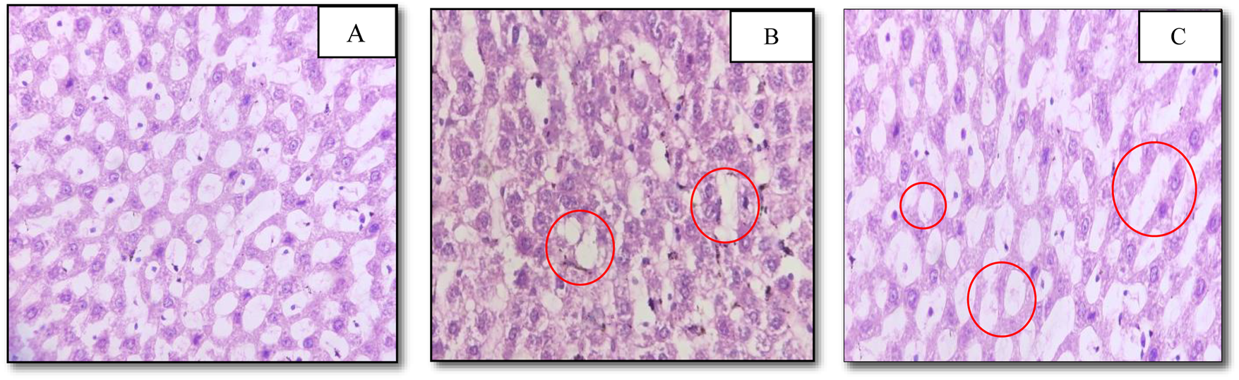 Three panels labeled A, B, and C show histological images of liver tissue stained in pink and purple. Panel A shows normal tissue with uniform cell structure. Panel B displays tissue with irregularities and cell damage marked by red circles. Panel C shows similar abnormalities with multiple red circles indicating areas of concern.