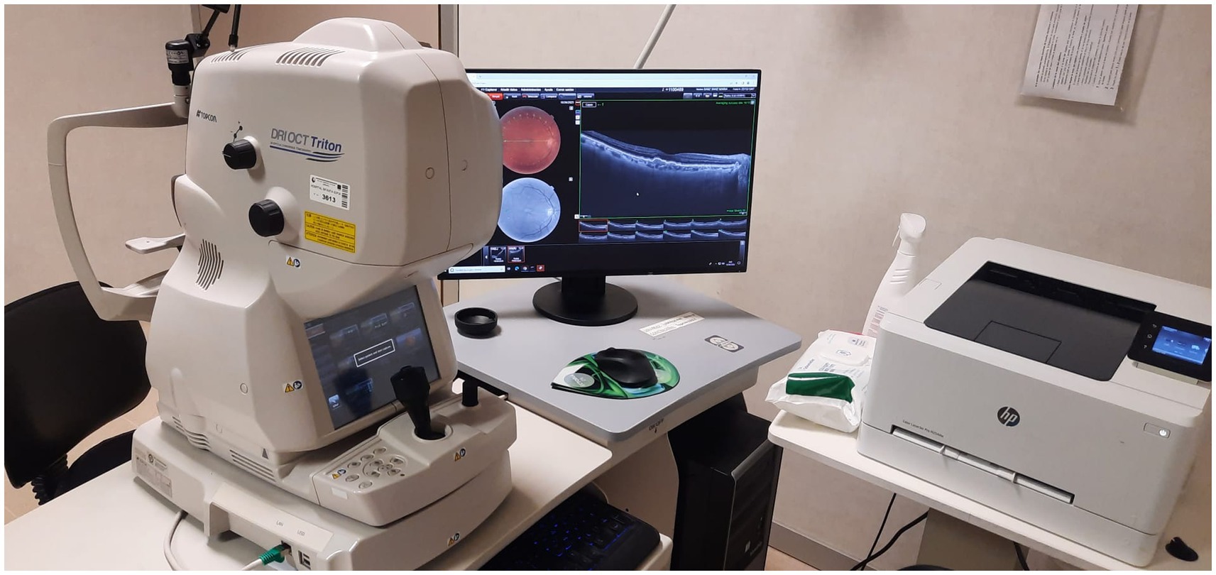 Medical imaging equipment setup with an optical coherence tomography (OCT) device labeled “DRI OCT Triton” next to a computer monitor displaying detailed retinal images and OCT scans. A printer is also visible on the right.