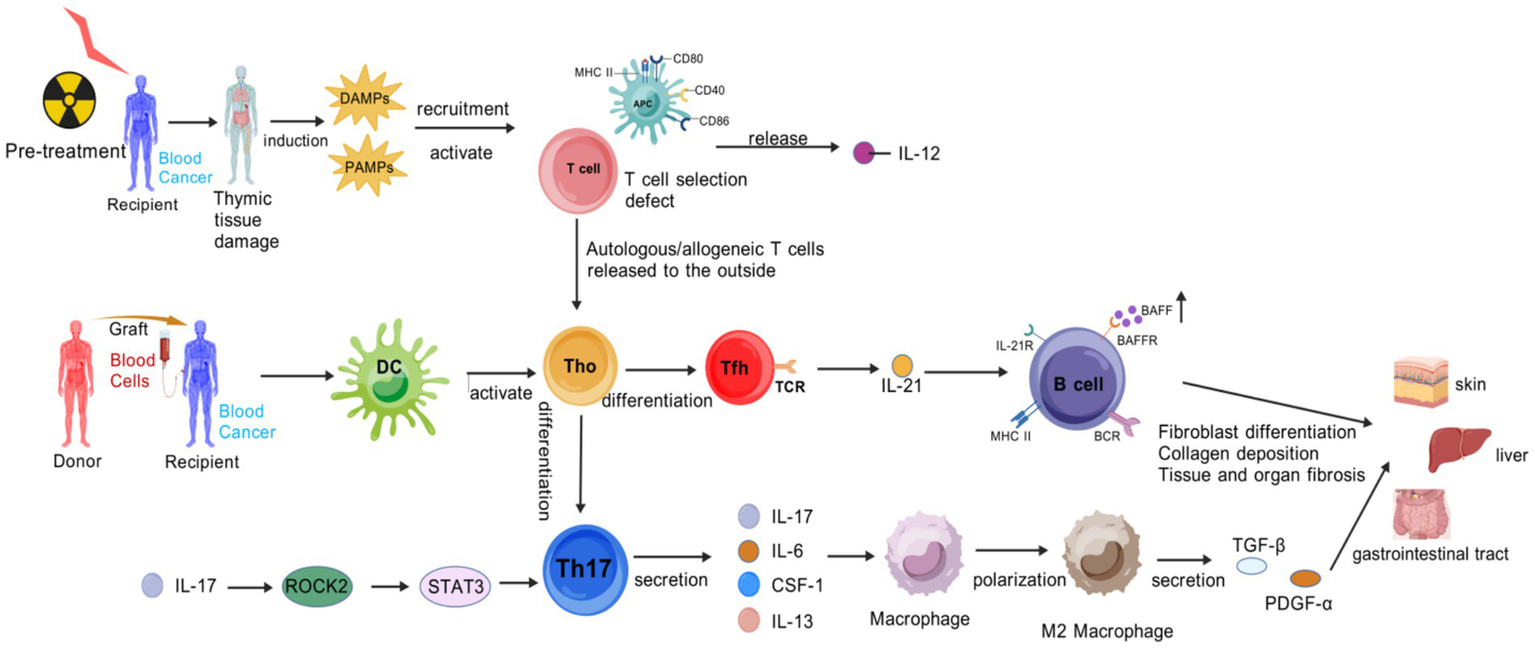 A flowchart illustrates the immune response pathway following blood cancer treatment. It begins with pre-treatment causing thymic tissue damage, releasing DAMPs, and activating T cells. DCs activate T cells leading to Th0 differentiation into Tfh and Th17 cells. Tfh cells interact with B cells, promoting fibroblast differentiation and collagen deposition, impacting skin, liver, and gastrointestinal tract tissue. Th17 secretes IL-17, affecting macrophages, which then secrete TGF-β and PDGF-α, contributing to tissue and organ fibrosis.