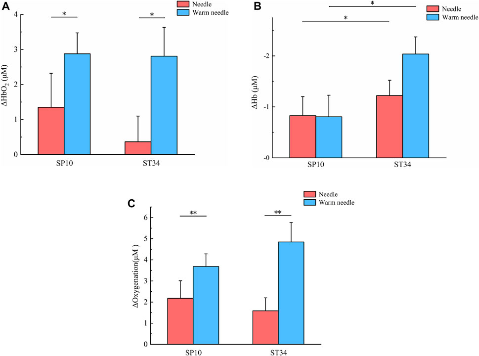 Bar charts labeled A, B, and C comparing needle effects on hemoglobin and oxygenation changes at points SP10 and ST34. The red bars represent the needle, and the blue bars represent the warm needle. Chart A shows significant hemoglobin oxygenation increases with the warm needle. Chart B shows mixed results for hemoglobin concentration changes, with notable differences for ST34. Chart C demonstrates significant oxygenation increases with the warm needle in both SP10 and ST34. Statistical significance is indicated by asterisks.