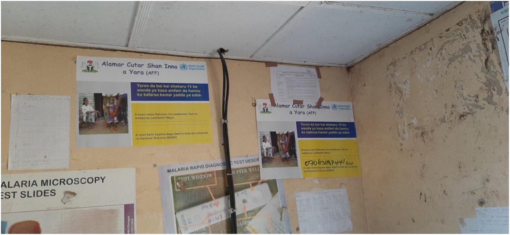 Posters and notices on a wall in an indoor setting. The central poster, titled in Hausa, features a photograph of a healthcare scene involving children with a focus on acute flaccid paralysis (AFP). Other materials include malaria diagnostic information and handwritten notes. The wall shows signs of wear.