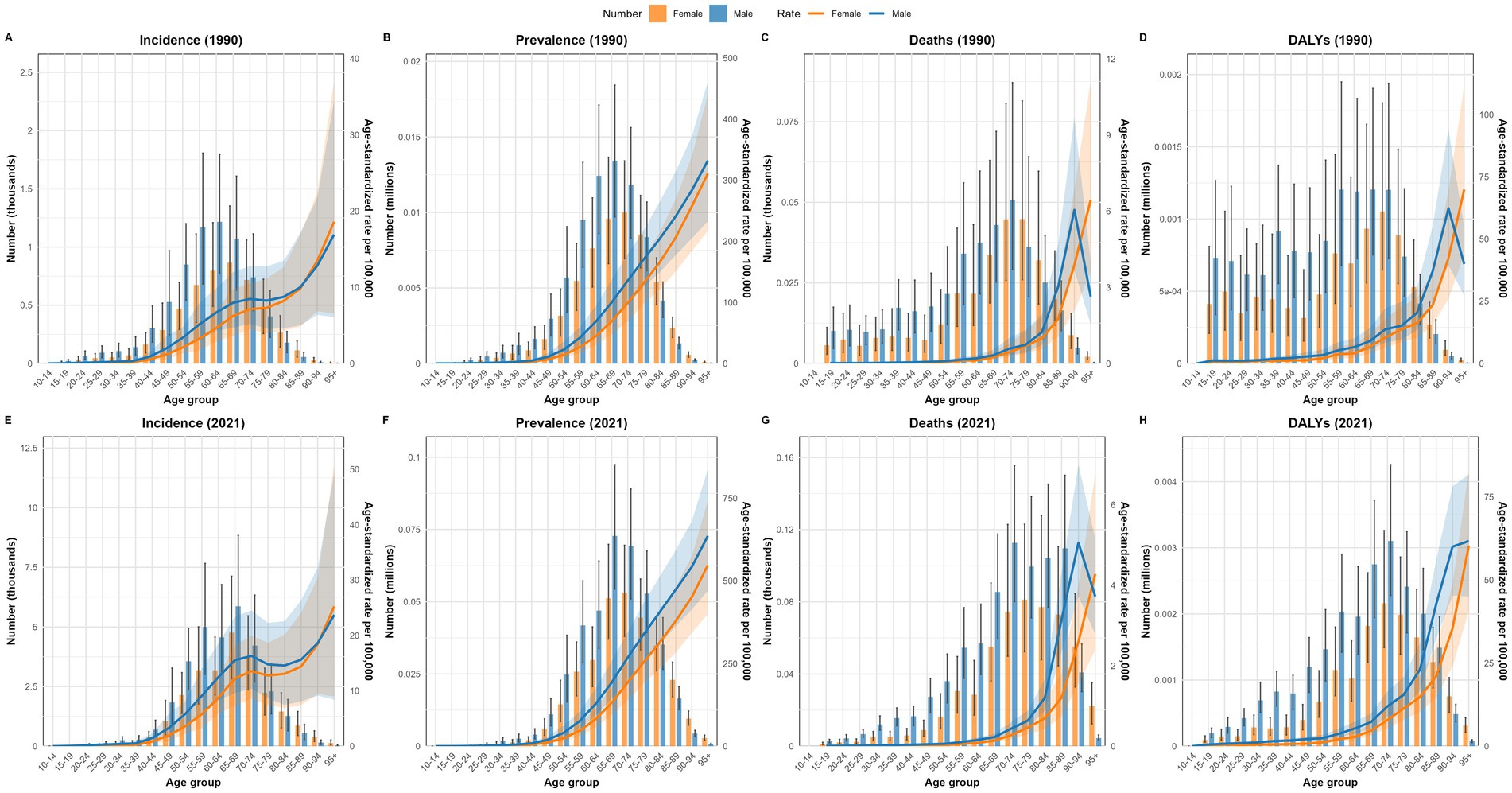 Eight bar charts depicting epidemiological data for the years 1990 and 2021. They show incidence, prevalence, deaths, and disability-adjusted life years (DALYs) by age group. Female data is in orange and male data in blue. Each chart includes age-standardized rates with shaded confidence intervals. Charts A-D represent 1990 data, while E-H show 2021. All charts indicate increasing trends with age.