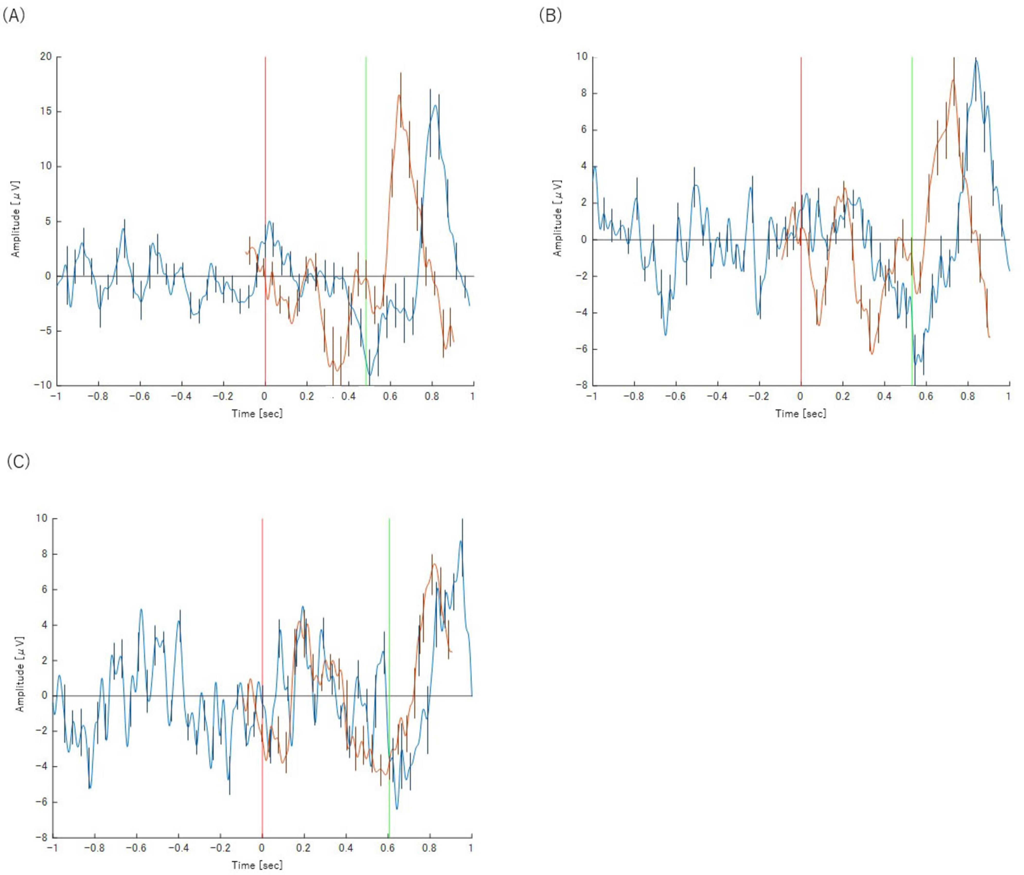 Three line graphs labeled A, B, and C show amplitude versus time in seconds. Each graph features two overlapping waveforms with distinct peaks and valleys. Vertical red and green lines indicate specific time markers. The amplitude range and overall pattern vary among the graphs.