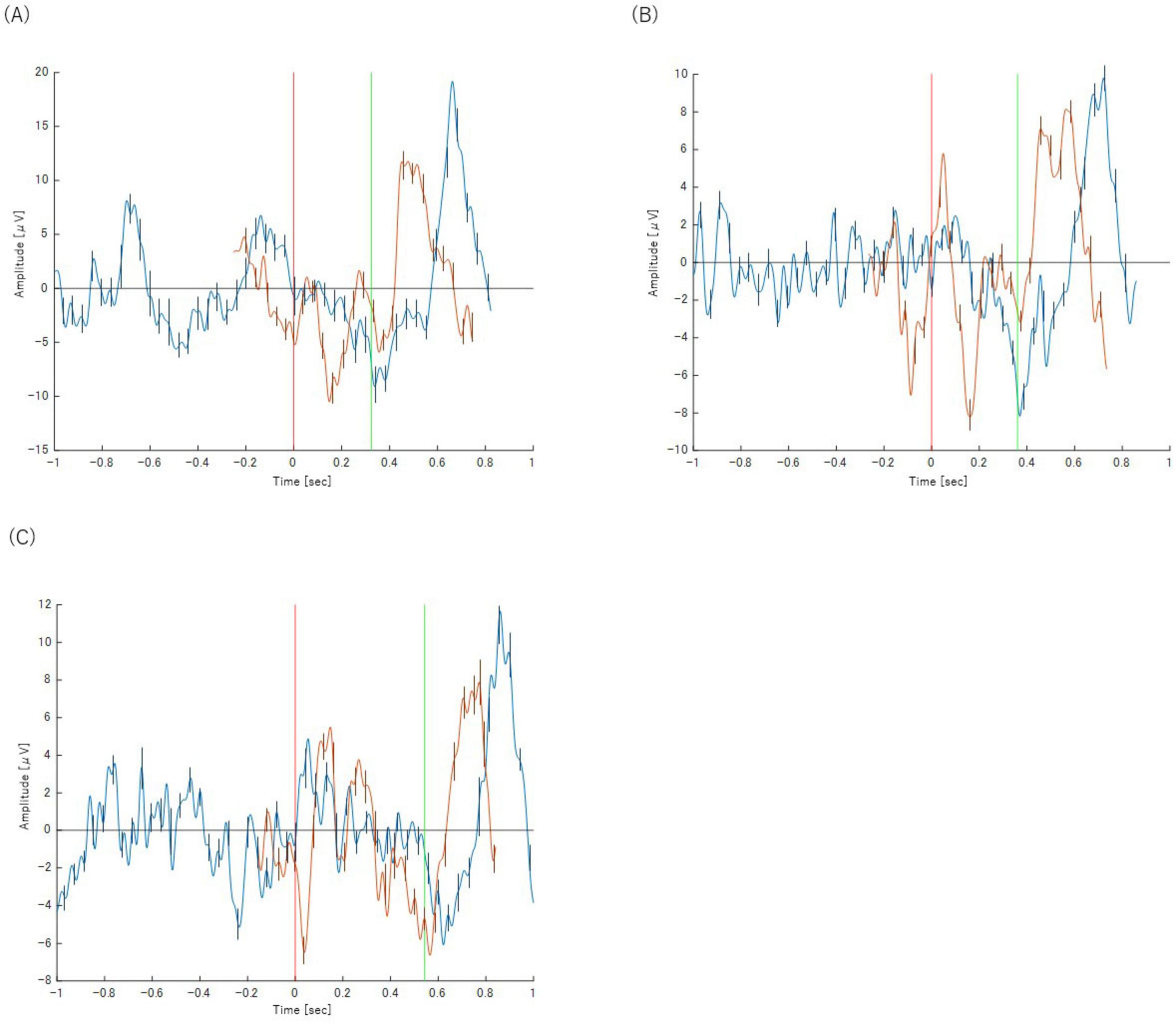 Graphs A, B, and C show amplitude over time with distinct waveform patterns in blue and orange. Vertical red and green lines highlight specific time markers around zero. Graphs vary in amplitude scale, depicting signal fluctuations.
