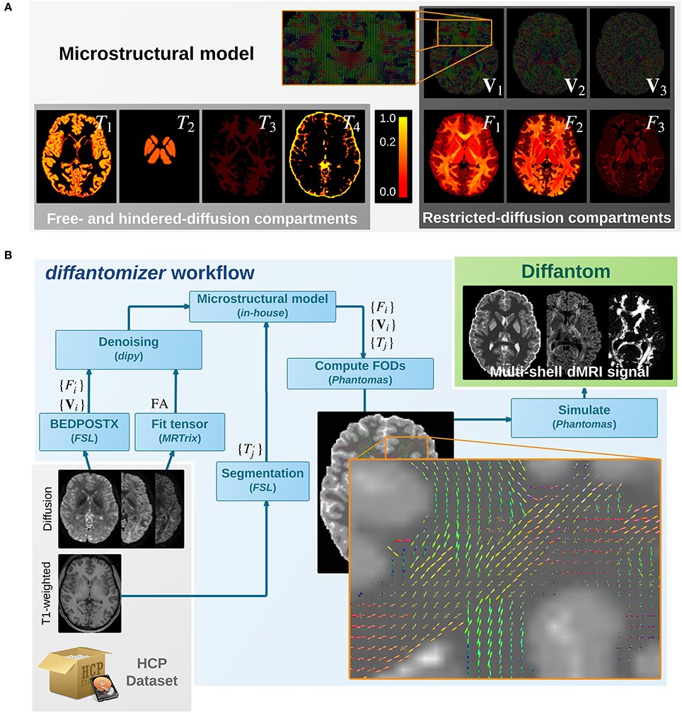 Phantom brain. MRI Phantom. Research Phantoms by MRI. Panda: a Pipeline Tool for diffusion MRI images.