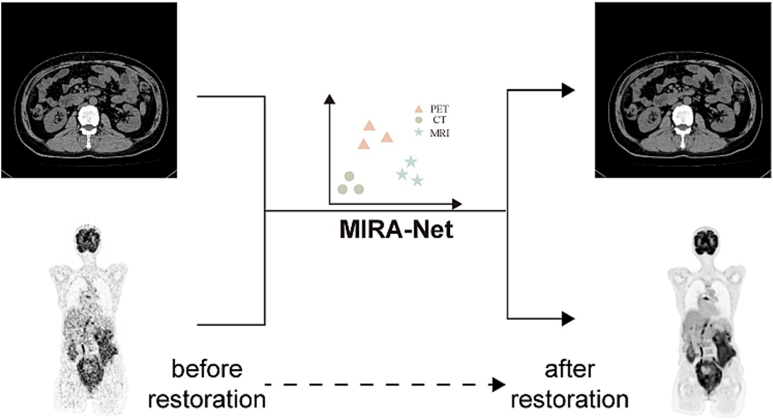 Medical imaging diagram showing a CT scan and a PET scan before and after processing through MIRA-Net. The CT scans are displayed at the top, with arrows indicating processing. The bottom images show PET scans labeled "before restoration" and "after restoration." A central graph indicates the types of scans: PET, CT, and MRI.