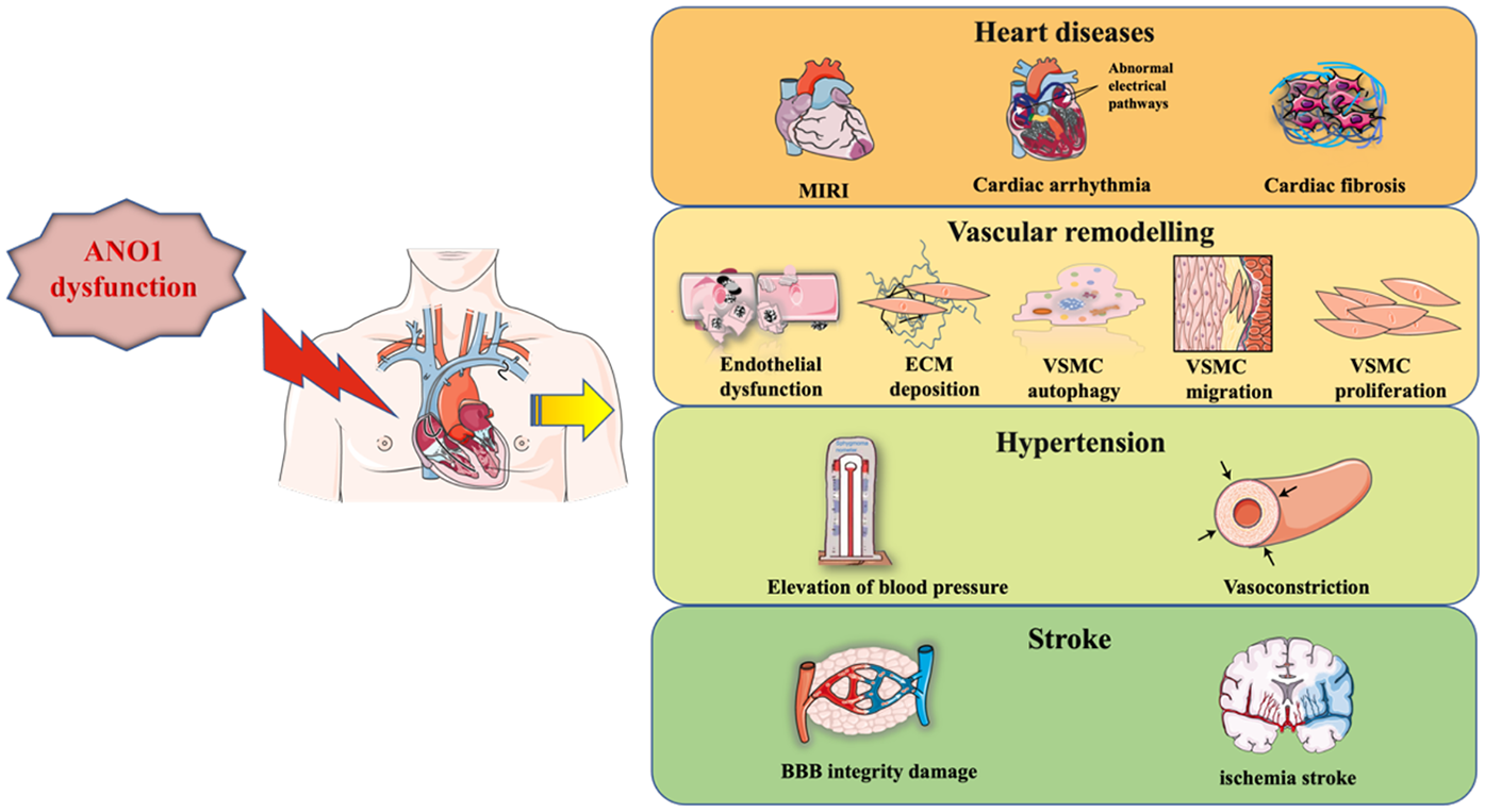 Diagram illustrating the impact of ANO1 dysfunction on cardiovascular health. Left section shows a human torso highlighting the cardiovascular system with ANO1 dysfunction by a red arrow. Right section details effects: Heart diseases (MIRI, cardiac arrhythmia, fibrosis), Vascular remodelling (endothelial dysfunction, ECM deposition, VSMC autophagy, migration, proliferation), Hypertension (elevated blood pressure, vasoconstriction), and Stroke (BBB integrity damage, ischemia).