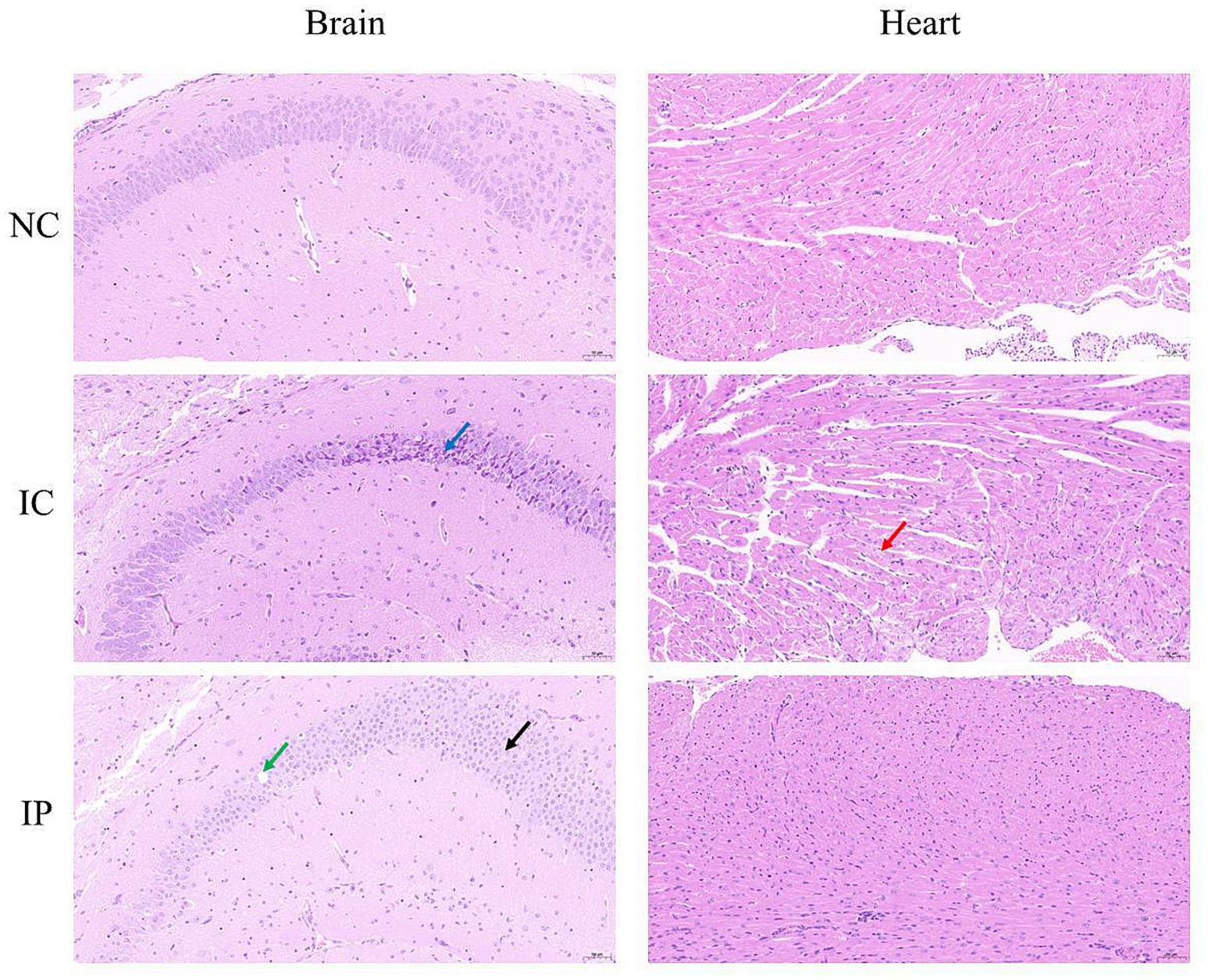 Histological images of brain and heart tissues are shown in six panels. The first column displays brain tissue sections labeled NC, IC, and IP, with arrows indicating different areas in each section. The second column shows corresponding heart tissue sections, similarly labeled, with an arrow highlighting a specific region in the middle section. The images reveal variations in cell arrangement and density between the different sections.