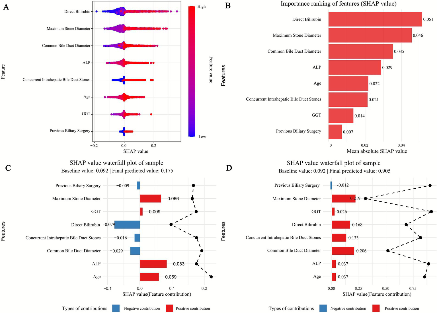 Panel A shows a violin plot with SHAP values for various features, indicating their influence on model predictions, with color gradients from low to high. Panel B presents a bar chart ranking features by mean absolute SHAP value, highlighting "Direct Bilirubin" as the most important. Panels C and D display SHAP value waterfall plots for two samples with baseline and final prediction values, showing individual feature contributions. Negative contributions are in blue, and positive contributions are in red.