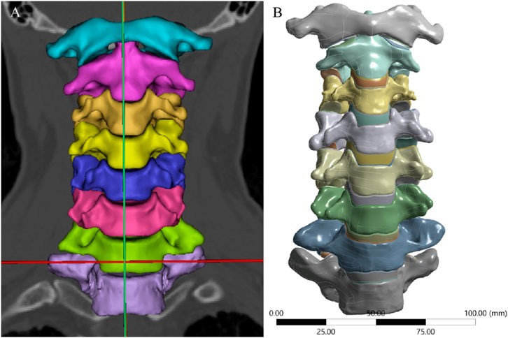 CT scan and 3D model of a cervical spine. Panel A shows a sagittal view with vertebrae highlighted in different colors. Panel B presents a 3D-rendered view, displaying vertebrae in corresponding colors, ranging from top to bottom with a scale bar indicating 0 to 100 millimeters.
