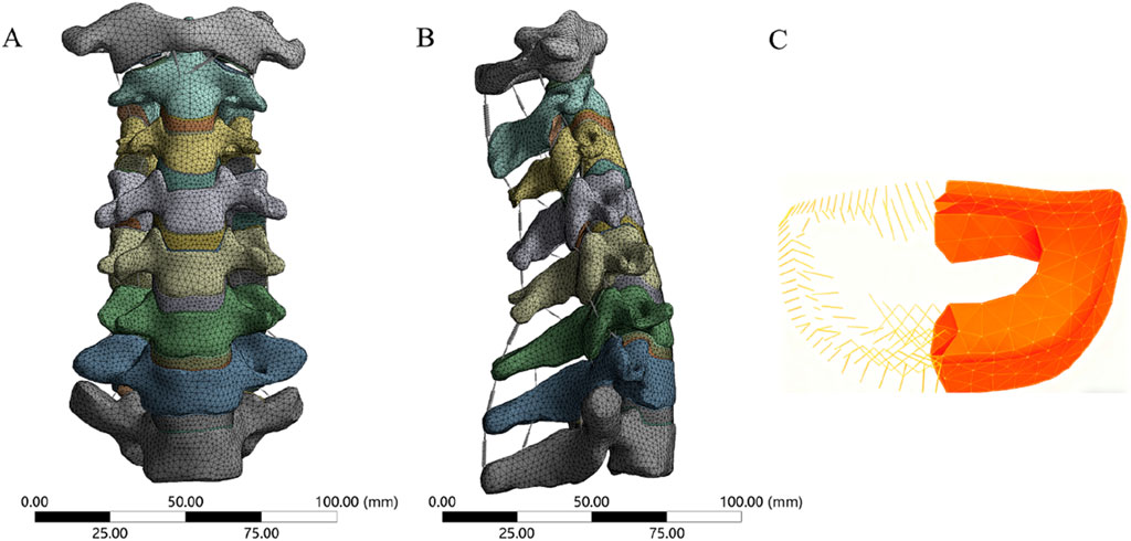 Three-panel illustration of a vertebral column. Panel A shows a front view with colored vertebrae. Panel B depicts a side view with the same color scheme. Panel C features an orange schematic highlighting structural details and measurements.