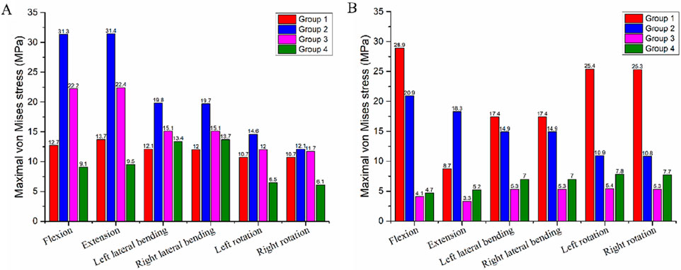 Bar charts labeled A and B compare maximal von Mises stress in megapascals across different movements: flexion, extension, lateral bending, and rotation. Group 1 is red, Group 2 is blue, Group 3 is magenta, and Group 4 is green. Chart A shows Group 2 having the highest stress in flexion and extension, while Group 1 leads in rotations. Chart B shows Group 1 having the highest stress across movements.