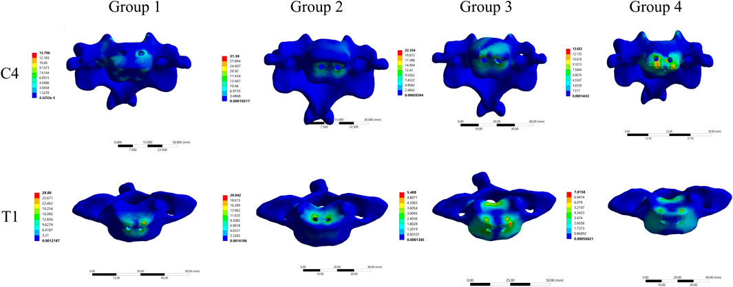 Four 3D models of spinal bones, labeled C4 and T1, are displayed. Each row contains two models, with corresponding heat maps showing stress distribution in Groups 1 to 4. Color scales range from blue to red, indicating varying stress levels.