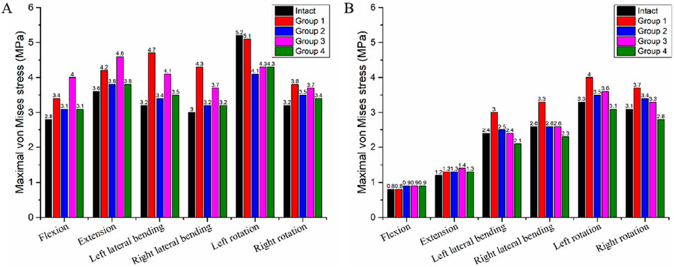 Bar graphs labeled A and B compare the maximal von Mises stress in megapascals (MPa) across different movements: flexion, extension, left lateral bending, right lateral bending, left rotation, and right rotation. Five categories—Intact, Group 1, Group 2, Group 3, and Group 4—are represented by black, red, blue, pink, and green bars, respectively. Each graph shows varying stress levels across the groups, with distinct differences in each movement category.
