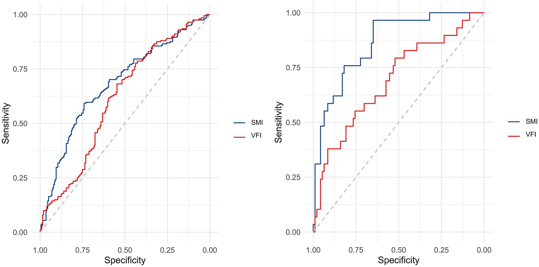 Two ROC curve plots compare the performance of SMI and VFI. The left plot shows both curves with moderate performance, while the right plot shows improved performance, especially for SMI. The diagonal line represents chance level.