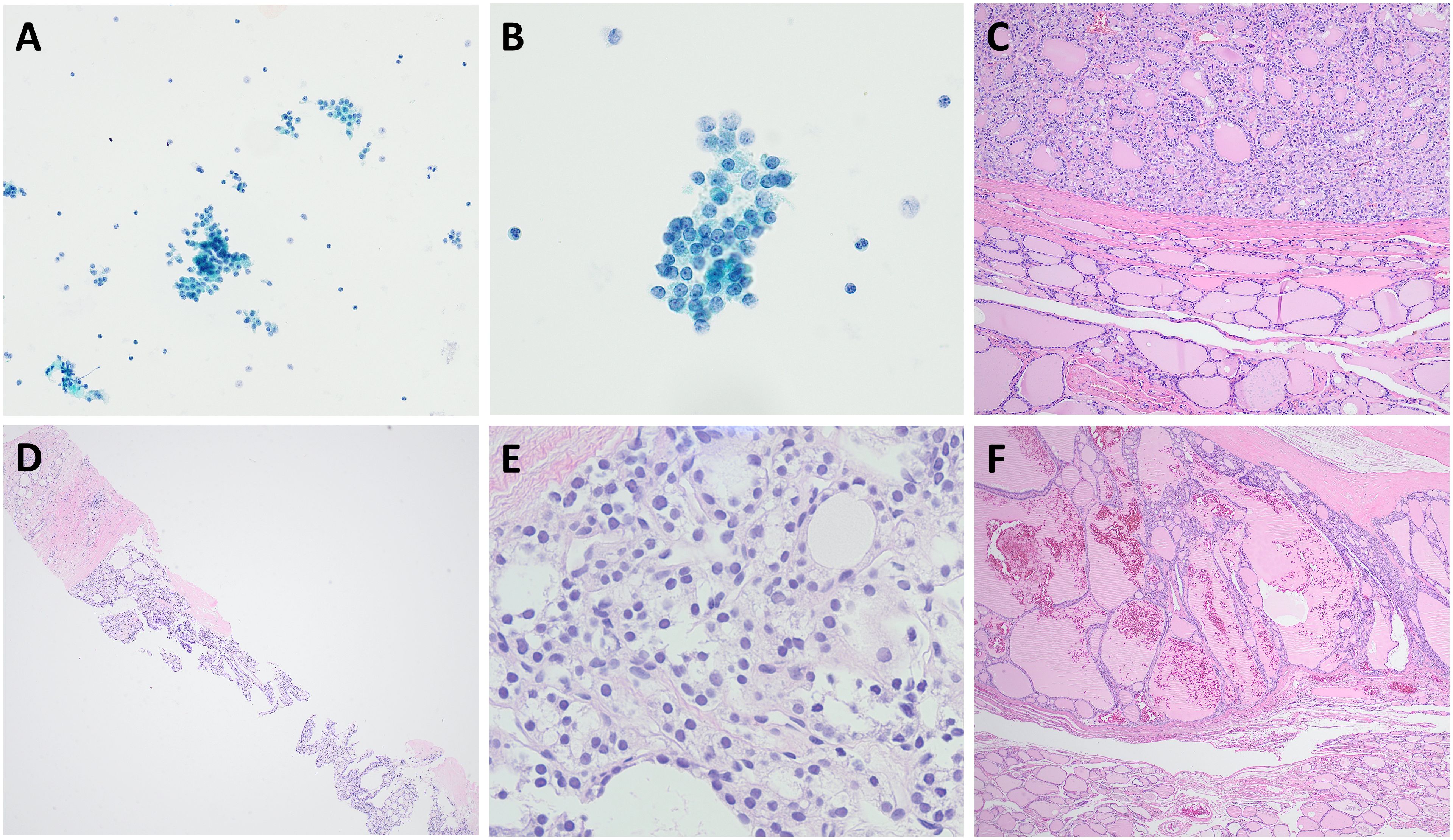 Microscopic images labeled A to F show various cell and tissue samples. A and B display clusters of blue-stained cells against a light background. C, D, and F display tissue sections with varying shades of pink and purple, indicating different structures and densities. E shows a close-up of cells with prominent nuclei in a pale matrix.