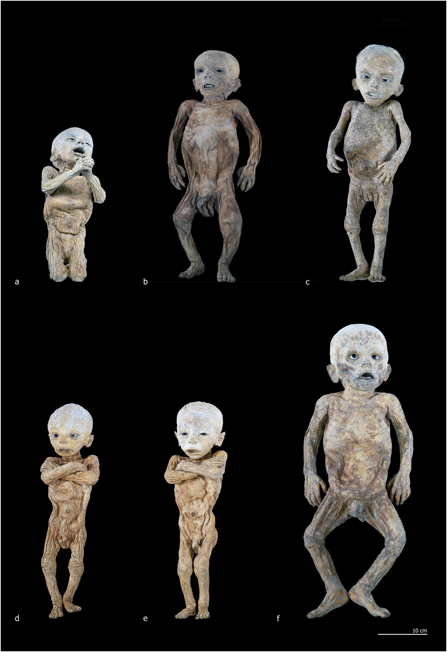 X-ray images of a fetus showing different views of skeletal features. Panel a displays a frontal view of the skull and torso. Panel b shows a lateral view of the full body. Panel c presents a side view of the head and chest. Panel d displays an anterior view of the torso with arms extended. Panel e shows a detailed view of an arm. Panel f provides an image of the lower leg and foot. Each panel includes measurement markers.