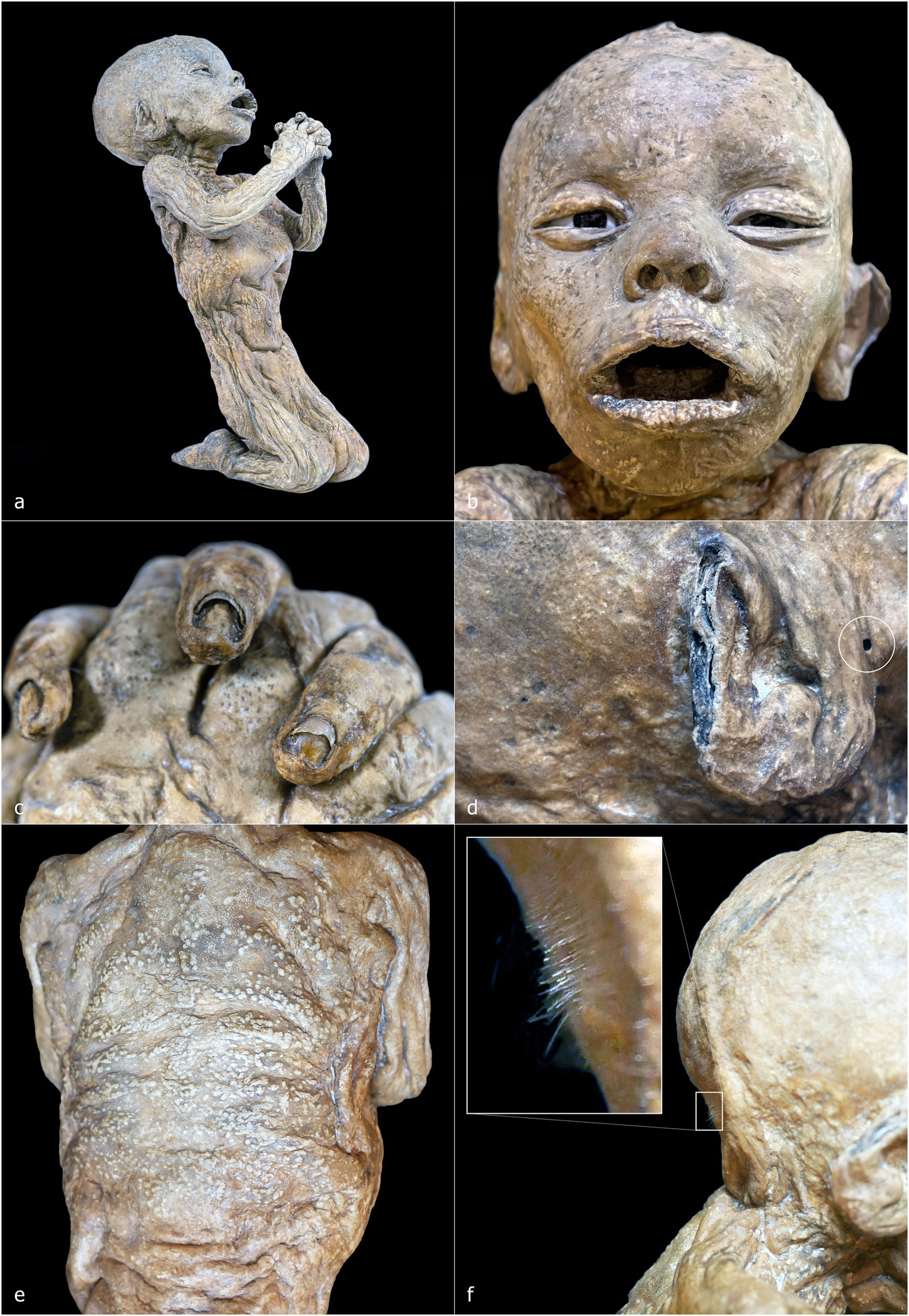 Four close-up images of a mummified child. Image a shows the left side of the head with two circled areas near the ear and cheek. Image b features the torso from the side, displaying detailed skin texture. Image c presents the right side of the head, with circled areas near the ear and scalp. Image d displays the side of the chest, emphasizing the wrinkled skin.