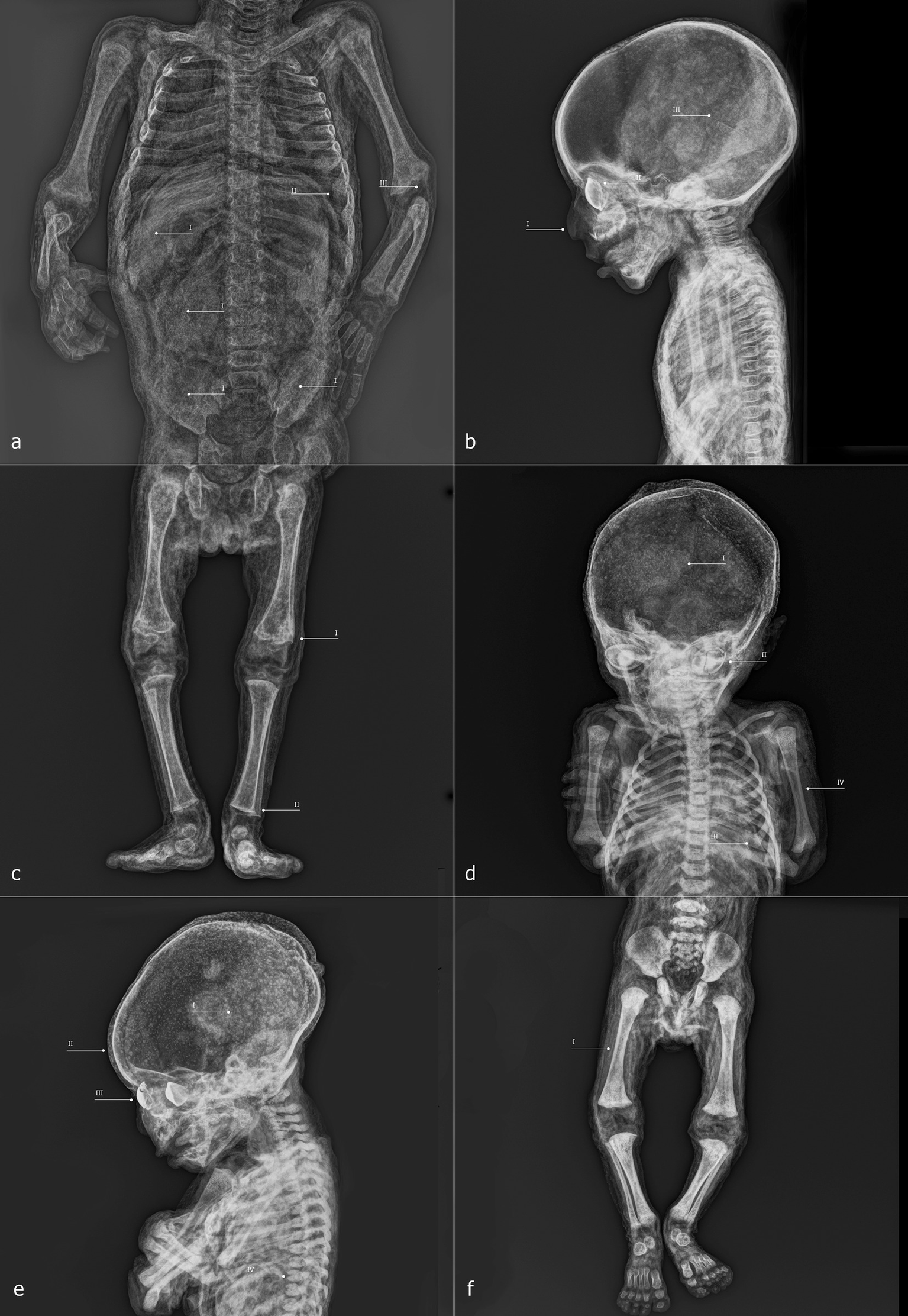A composite image showing a mummified figure in various views and close-ups. Panel (a) depicts the full body in a kneeling position with clasped hands. Panel (b) focuses on the face with an open mouth. Panel (c) shows a close-up of the fingers and nails. Panel (d) highlights an ear. Panel (e) displays the texture of the back. Panel (f) includes close-up details of the skin's texture and hair. The background is black, enhancing the figure's details.