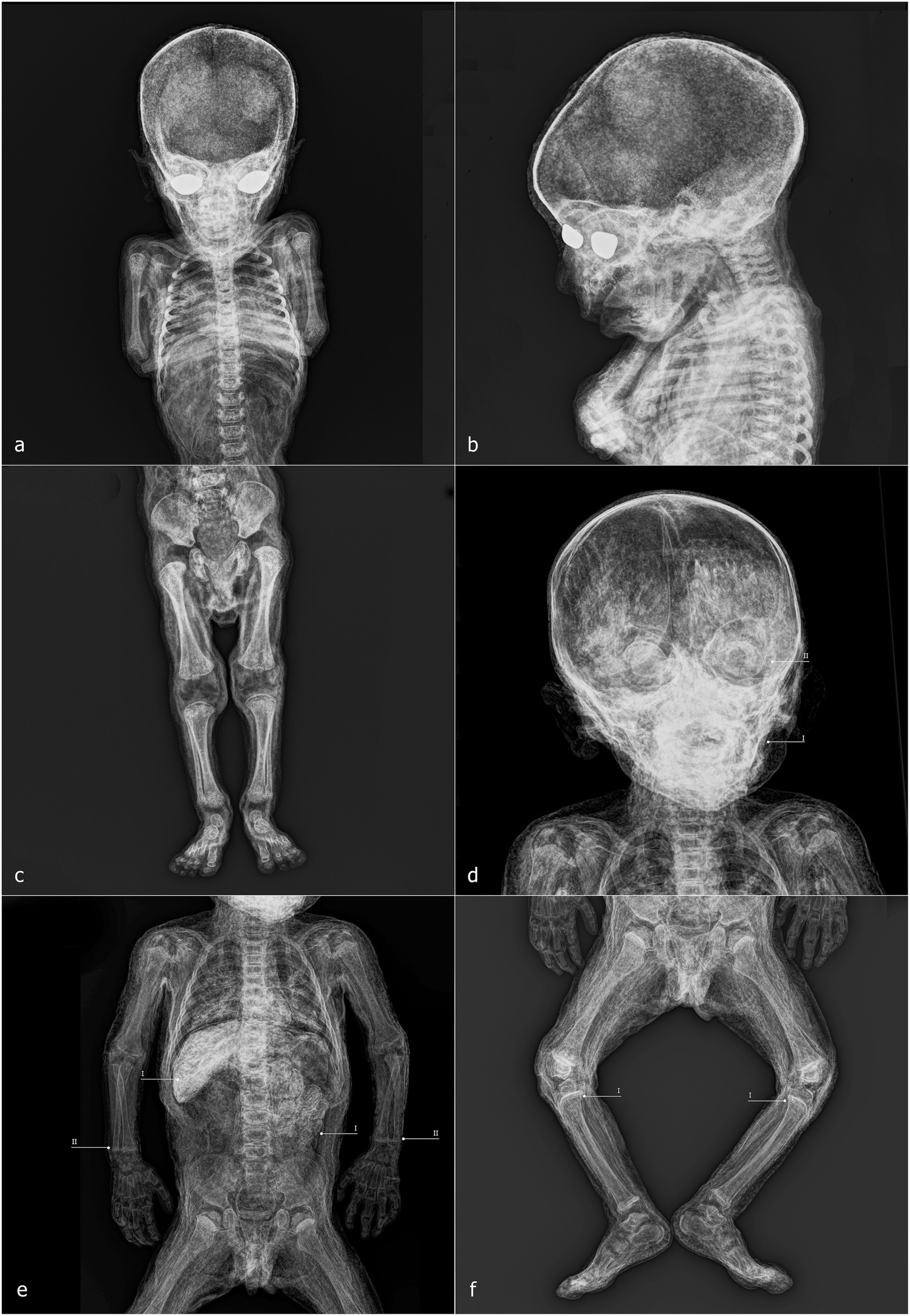 Six mummified child figurines displayed against a black background, labeled a to f. Each has a distinct pose and detailed texture suggesting age and vulnerability. A scale indicates size in the bottom right.