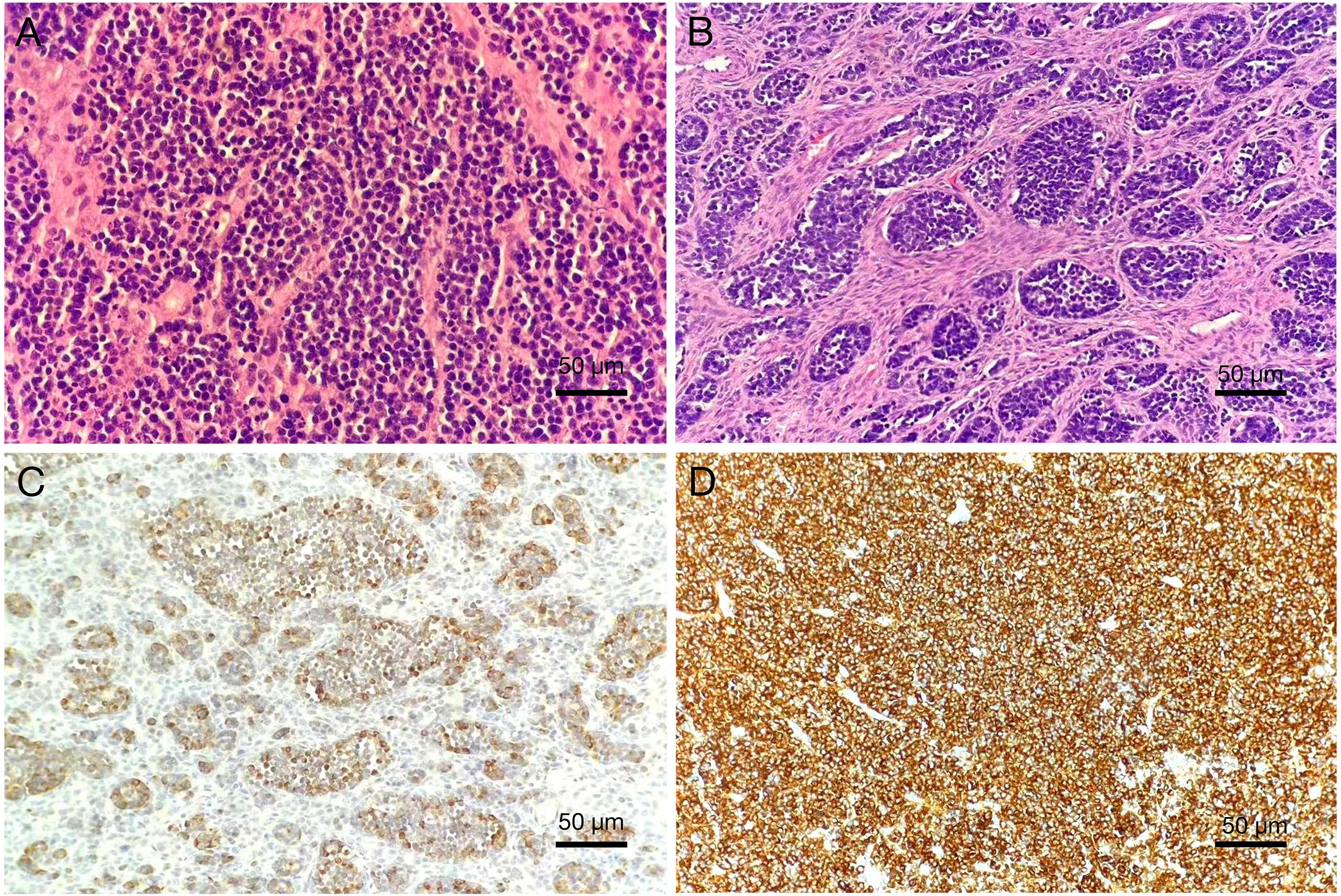 Four microscopic images show various tissue samples. The top left image displays densely packed purple and pink cells. The top right image shows pink fibrous tissue with purple nuclei. The bottom left image depicts lighter, stained tissue with scattered brown areas. The bottom right image features a dense cluster of brown-stained cells. Each image includes a scale bar measuring 50 micrometers.