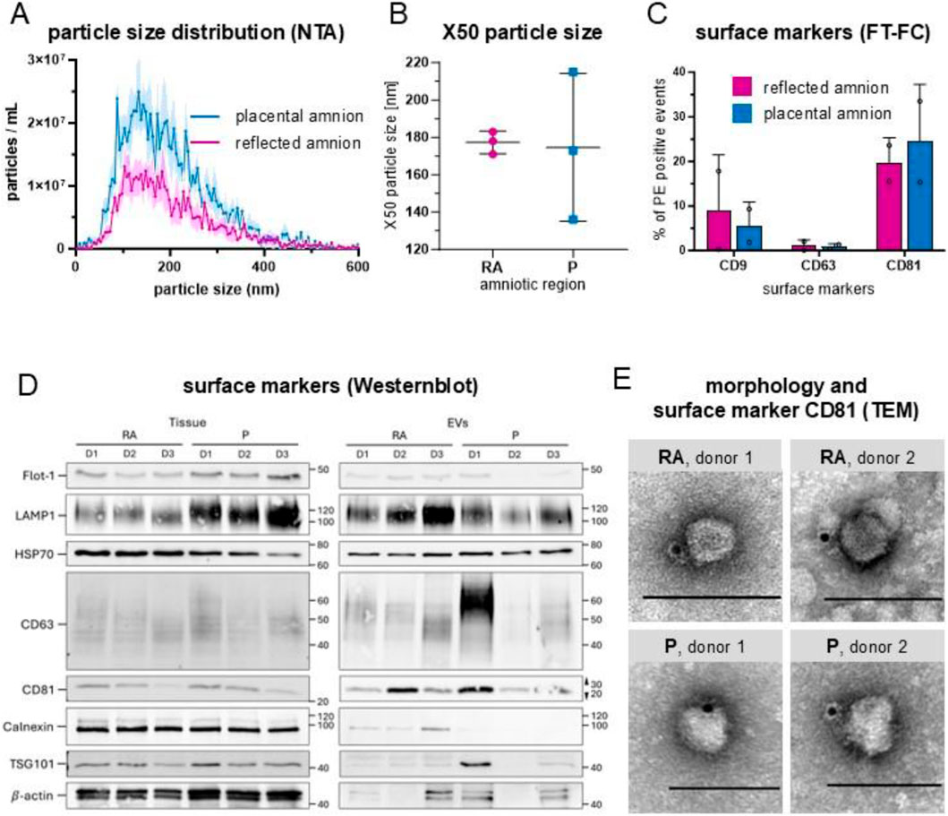 Composite image with five panels. Panel A shows a line graph of particle size distribution (NTA) comparing placental (blue) and reflected (pink) amnion. Panel B presents a scatter plot of X50 particle size for RA and P amniotic regions. Panel C shows a bar chart of surface markers (FT-FC) with CD9, CD63, CD81 and their corresponding percentages. Panel D displays Western blot images of various surface markers for RA and P tissue and EVs across three donors. Panel E includes four TEM images showing the morphology and CD81 surface marker for RA and P from two donors.