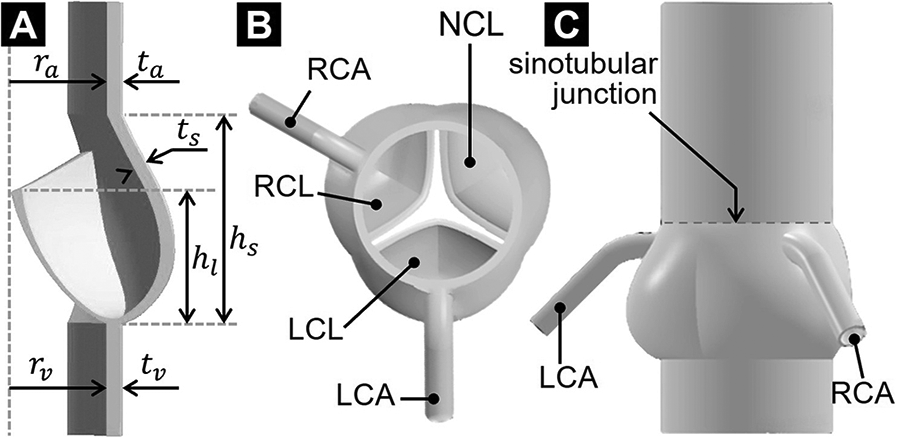 Diagram illustrating three views of heart anatomy related to the aortic root. Panel A shows a cross-sectional view with labeled dimensions: outer radius \\(r_a\\), wall thickness \\(t_a\\), and leaflet height \\(h_l\\). Panel B depicts a top view of the aortic valve with labels RCA, RCL, NCL, LCL, and LCA, indicating different cusps and coronary arteries. Panel C presents a frontal view highlighting the sinotubular junction and connections to the RCA and LCA.