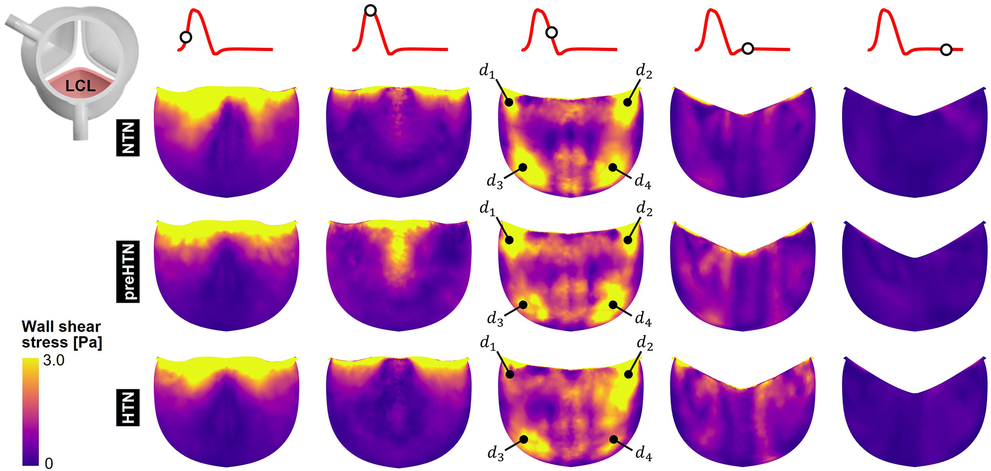 Diagram showing three rows of colored heat maps representing wall shear stress in aortic valves under three conditions: NTN, preHTN, and HTN. Yellow to purple gradient indicates stress levels from high to low. Small red graphs above each map depict blood flow patterns, and specific points, labeled \\(d_1\\) to \\(d_4\\), on some maps highlight key areas of stress. An inset diagram shows an aortic valve labeled \"LCL.\" A color scale on the left indicates shear stress in Pascals from zero to three.