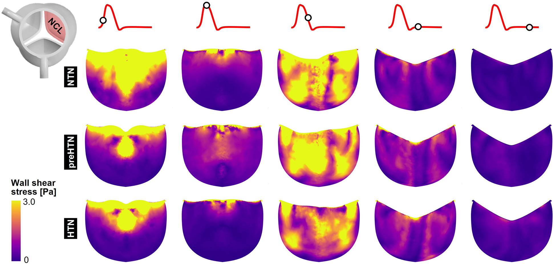Diagram showing wall shear stress distribution during different phases of cardiac cycles. The top left displays an aortic valve illustration indicating the NCL region. Three rows labeled NTN, PreHTN, and HTN show purple and yellow gradient maps representing varying shear stresses across the cardiac cycle. A legend indicates shear stress ranges from 0 to 3 pascals.