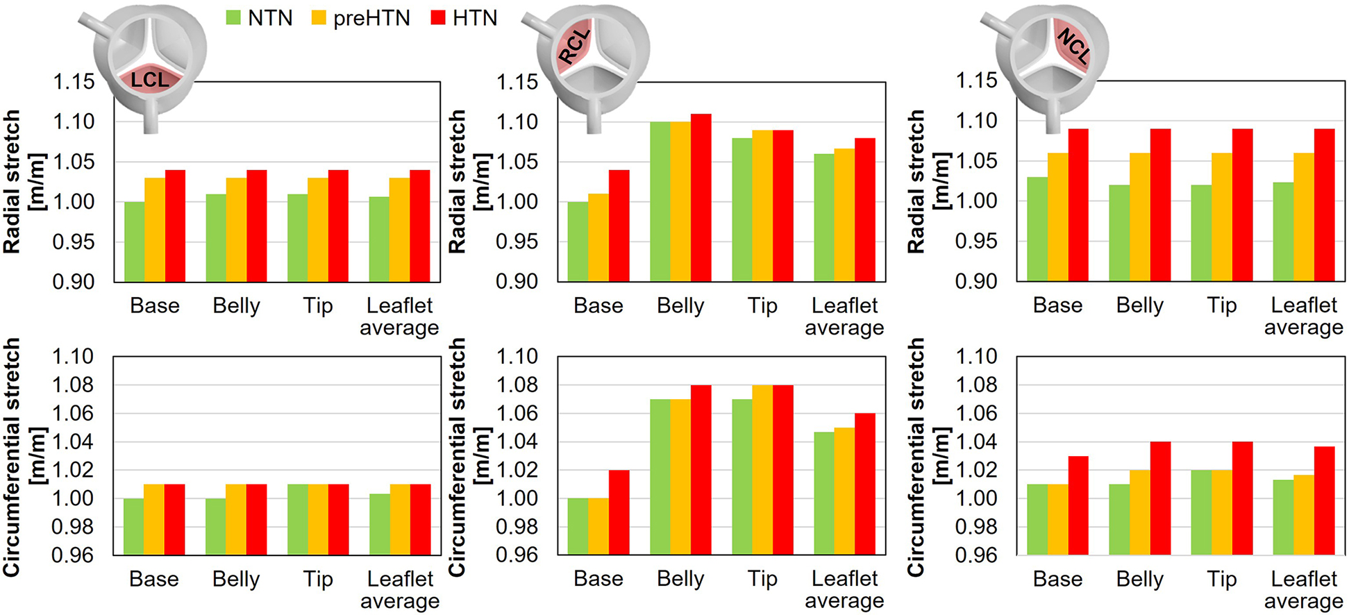 Bar graphs compare radial and circumferential stretch, measured in millimeters per millimeter, across different parts of leaflets labeled LCL, RCL, and NCL. Color-coded bars represent NTN, preHTN, and HTN.
