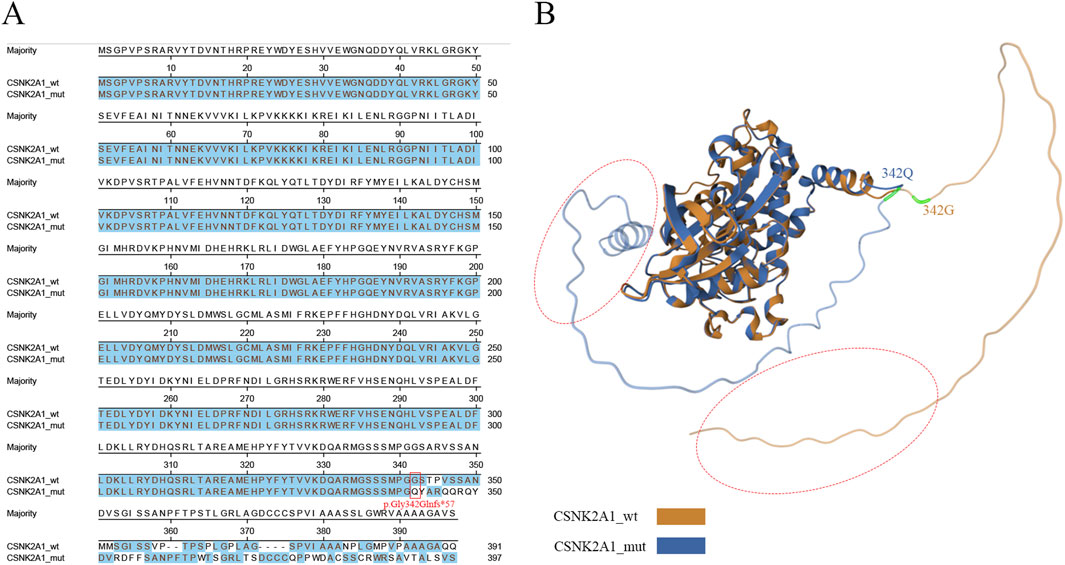 Diagram with two panels labeled A and B. Panel A shows the sequence alignment of CSNK2A1 wild type (wt) and mutant (mut) protein sequences, highlighting differences. Panel B illustrates a 3D protein structure comparing the CSNK2A1 wt in brown and CSNK2A1 mut in blue, with labels for positions 342Q and 342G. A red ellipse highlights a structural feature, indicating regions of differences between two groups.