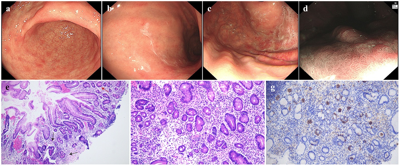 Images depict various medical imaging views. Panels (a) through (d) display endoscopic images showing different parts of the gastrointestinal tract with varying textures and colors. Panels (e) and (f) feature microscopic views of tissue samples, highlighting glandular structures and cellular details with purple staining. Panel (g) shows a tissue sample with blue staining, indicating different tissue structures and patterns.