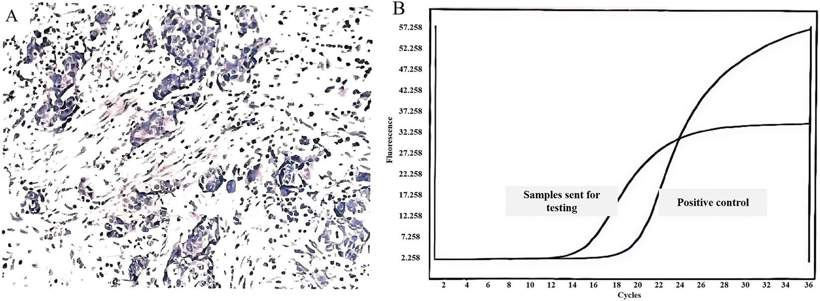 Panel A shows a histological tissue section with densely packed, darkly stained nuclei and scattered lighter areas. Panel B is a line graph showing fluorescence versus cycles in a quantitative PCR assay, with separate curves labeled “Samples sent for testing” and “Positive control,” indicating sample amplification comparison.