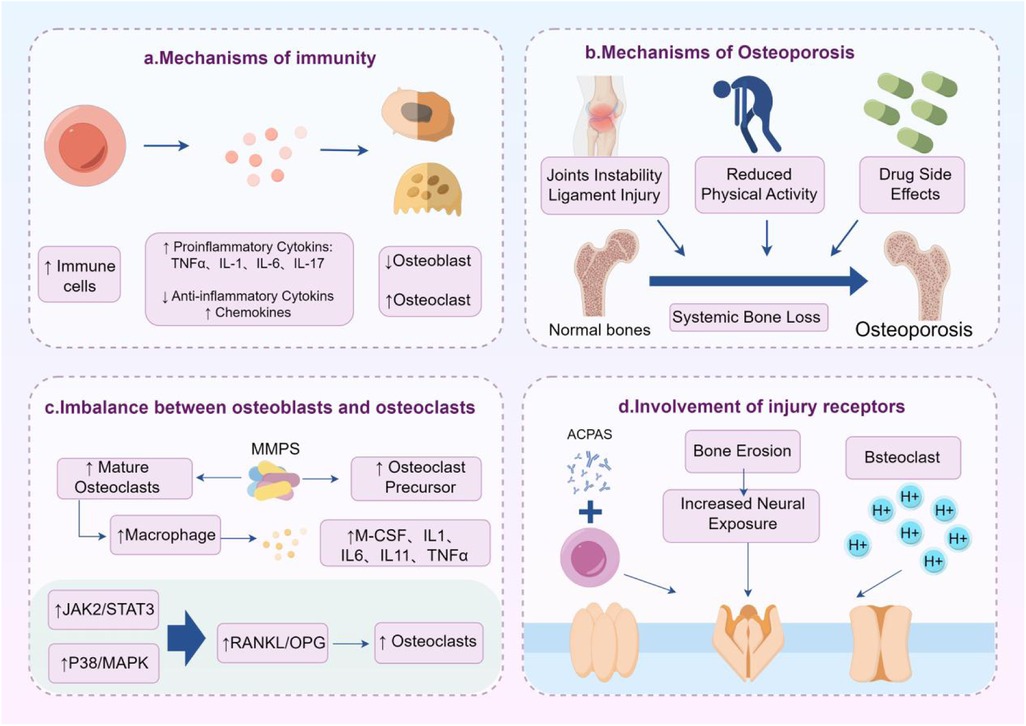 Diagram showing four sections related to bone health: a) Immunity mechanisms with immune cells affecting osteoblasts and osteoclasts through cytokines. b) Osteoporosis mechanisms detailing joint instability, reduced activity, and drug effects leading to bone loss. c) Imbalance between osteoblasts and osteoclasts with macrophages, cytokines, and pathways like JAK2/STAT3 and P38/MAPK increasing osteoclasts. d) Injury receptor involvement showing bone erosion and increased neural exposure.