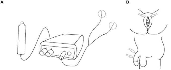 Frontiers Subject Controlled On Demand Dorsal Genital Nerve 