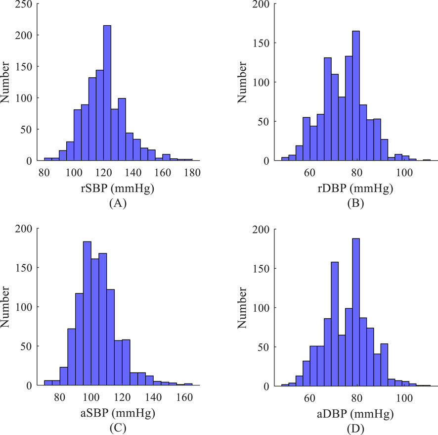 Four histograms illustrate blood pressure distributions. (A) displays resting systolic blood pressure (rSBP) from 80 to 180 mmHg. (B) shows resting diastolic blood pressure (rDBP) from 60 to 100 mmHg. (C) presents active systolic blood pressure (aSBP) from 80 to 160 mmHg. (D) depicts active diastolic blood pressure (aDBP) from 60 to 100 mmHg. Each histogram shows frequency counts, with peaks indicating common pressure ranges.