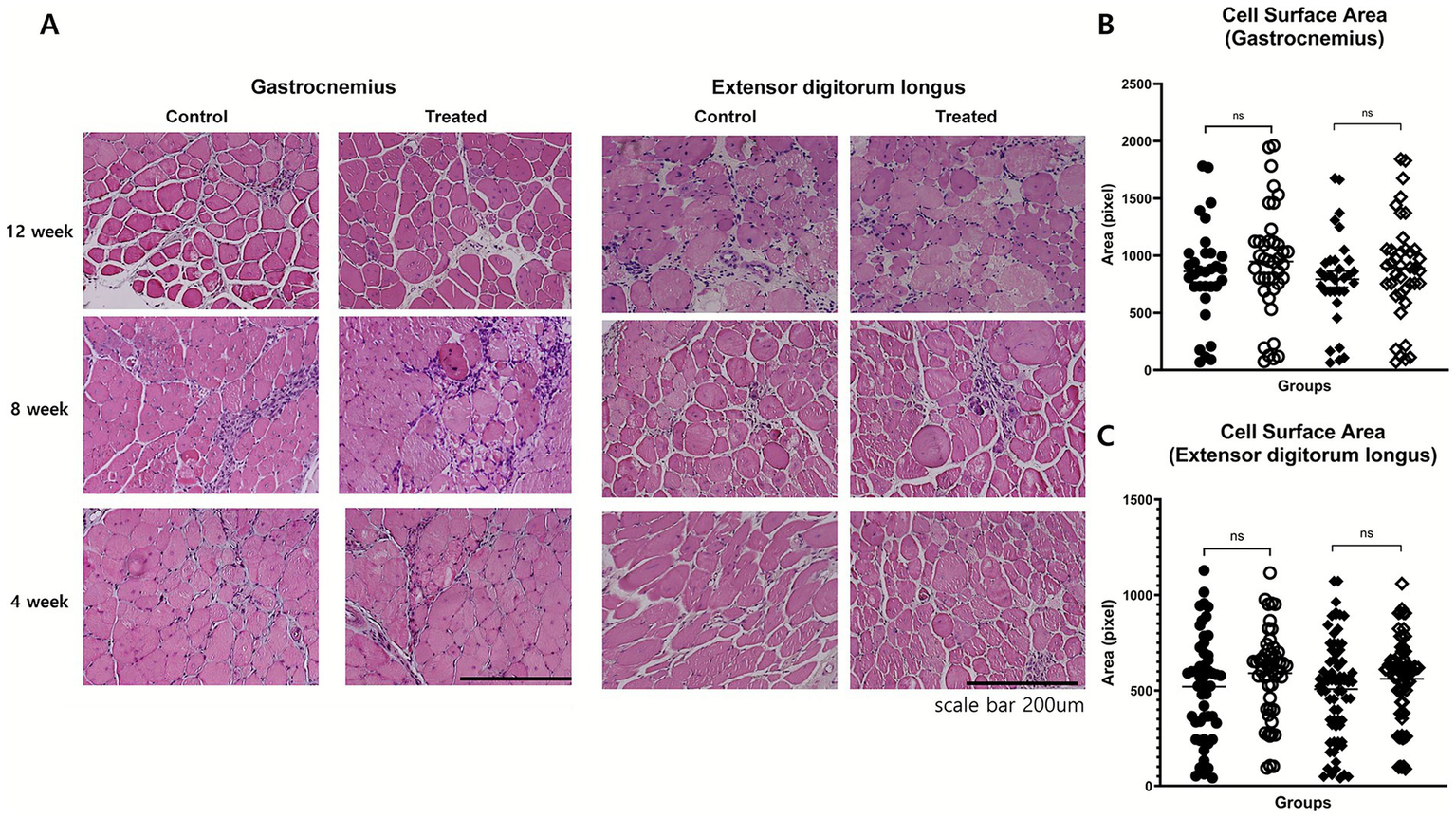 Panel A shows histological images of the gastrocnemius and extensor digitorum longus muscles from control and treated groups at 12, 8, and 4 weeks. Panels B and C present scatter plots of cell surface area measurements for the gastrocnemius and extensor digitorum longus, respectively, indicating no significant differences (ns) between groups. Scale bar is 200 micrometers.