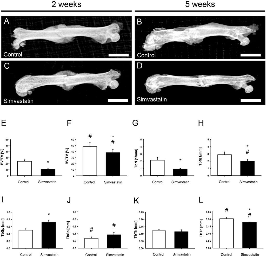 X-ray images and bar graphs comparing bone structure in control and simvastatin-treated groups over two and five weeks. Panels A-D show bone images with notable differences in density between treatments. Panels E-L show bar graphs illustrating metrics such as bone volume, thickness, number, and separation. Simvastatin treatment appears to influence bone properties, as indicated by statistical markers like asterisks and hashtags, suggesting significant differences across conditions and time points.